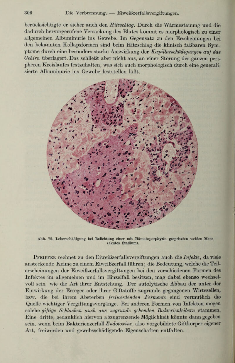 berücksichtigte er sicher auch den Hitzschlag. Durch die Wärmestauung und die dadurch hervorgerufene Versackung des Blutes kommt es morphologisch zu einer allgemeinen Albuminurie ins Gewebe. Im Gegensatz zu den Erscheinungen bei den bekannten Kollapsformen sind beim Hitzschlag die klinisch faßbaren Sym- ptome durch eine besonders starke Auswirkung der Kapillarschädigungen auf das Gehirn überlagert. Das schließt aber nicht aus, an einer Störung des ganzen peri- pheren Kreislaufes festzuhalten, was sich auch morphologisch durch eine generali- sierte Albuminurie ins Gewebe feststellen läßt. ■5 i> jv*' . v ■. v ■ » * V»? :♦ * j * v 7. f '**'7 ■ /' *' ' - .//* -V .V ‘ I - • ..'V a • .. • * $ ' . ' * ' A-, . + '' S . , r'if c * Abb. 72. Leberschädigung bei Belichtung einer mit Hämatoporphyiin gespritzten weißen Haus (akutes Stadium). Pfeiffer rechnet zu den Eiweißzerfallsvergiftungen auch die Infekte, da viele ansteckende Keime zu einem Eiweißzerfall führen; die Bedeutung, welche die Teil- erscheinungen der Eiweißzerfallsvergiftungen bei den verschiedenen Formen des Infektes im allgemeinen und im Einzelfall besitzen, mag dabei ebenso wechsel- voll sein wie die Art ihrer Entstehung. Der autolytische Abbau der unter der Einwirkung der Erreger oder ihrer Giftstoffe zugrunde gegangenen Wirtszellen, bzw. die bei ihrem Absterben freiwerdenden Fermente sind vermutlich die Quelle wichtiger VergiftungsVorgänge. Bei anderen Formen von Infekten mögen solche giftige Schlacken auch aus zugrunde gehenden Bakterienleibern stammen. Eine dritte, gedanklich hiervon abzugrenzende Möglichkeit könnte dann gegeben sein, wenn beim Bakterienzerfall Endotoxine, also vorgebildete Giftkörper eigener Art, freiwerden und gewebsschädigende Eigenschaften entfalten.