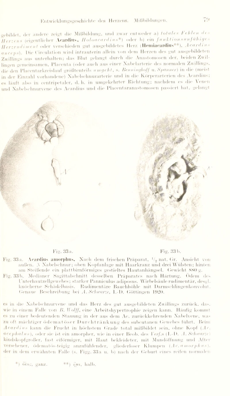 F.nlwirklimgSLiesehichte des Herzens. Mißbildungen. i,clnlilei. der andere zeigt, die Mißbildung, und zwar entweder a) totale* Fehlen <l> * Jln :iii' (einen! lielier Vciinliils, //olnti citnl i ns*) oder I >) ein / un 1/1 o n * n >i J äh i;/' - Herznnli ment oder verschieden gut ausgehildetcs Iler/. (llemineiirdius**). Aranlin- anreps). Die Birculation wird intrauterin allein von dem Herzen des gut ausgebildeten Zwillings aus unterhalten: das Blut gelangt durch die Anastomosen der, beiden Zwil lingen gemeinsamen. I’laeenta (oder auch aus einer Xabelarterie des normalen Zwillings, die den Blaccntarkrcislauf größtenteils umgeht, s. Brüninghoff u. Spanner) in die (meist in der Kinzahl vorhandene) Xahelsehnurarterie und in die Körperarterien des Aeardins: es lauft also in eentripetaler, d. h. in umgekehrter Hiehtung; nachdem es die Venen und Xabelschnurvonc des Aeardins und die l'laeentaranastomosen passiert hat. gelangt Fig. 33a. Fig. 33 b. Fig. 33a. \canlius iimorphus. Nach dem frischen Präparat, '/2 nat. <lr. Ansicht von außen. A Xabelselmur: oben Kopfanlage mit Haarkranz und drei Wülsten; hinten am Steißende ein platt bimförmiges gestieltes Hautanhängsel. Bewacht SSO g. Fig. 33 b. Medianer Sagittalschnitt desselben Bräparates nach Härtung. Odem des l 'nt erbaut Zellgewebes: starker l’annieulus adiposus. Wirbelsäule rudimentär, desgl. knöcherne Schädelbasis. Hudiment.äre Bauchhöhle mit I>arnisehlingenkouvolu1. • tenaue Beschreibung bei .1. Scluntrze, l.-l). Böttingen 1020. es in die Xabelschnurvcne und das Herz des gut ausgehildeten Zwillings zurück, das. wie in einem Falle von II. Wolff, eine Arbeitshypertropliie zeigen kann. Häufig kommt es zu einer bedeutenden Stauung in der aus dem Ae. zurückkehrenden Xahelvenc. was zu oft mächtiger ödemat öse r I) u re ht rä nk ung des subeutanen Bewebes führt. Beim Arartlins kann die Frucht in höchstem (trade total mißbildet sein, ohne Kopl (.Ir. acejiha l u * ), oder sie ist ein amorphe]-, wie in einer Beob. des I rr/.s (I. -1). A . Srlnrnrzi kindskopfgroßer, fast eiförmiger, mit Maut bekleideter, mit Mundöffnung und Aftei versehener, ödematös-teigig anzufühlender, gliederloser Klumpen (Ar. a morph u * \. der in dem erwähnten Falle (s. l-’igg. 33a n. b) nach der Beburt eines reilen normalen *) ö/.og, ganz. **) ipu. halb.