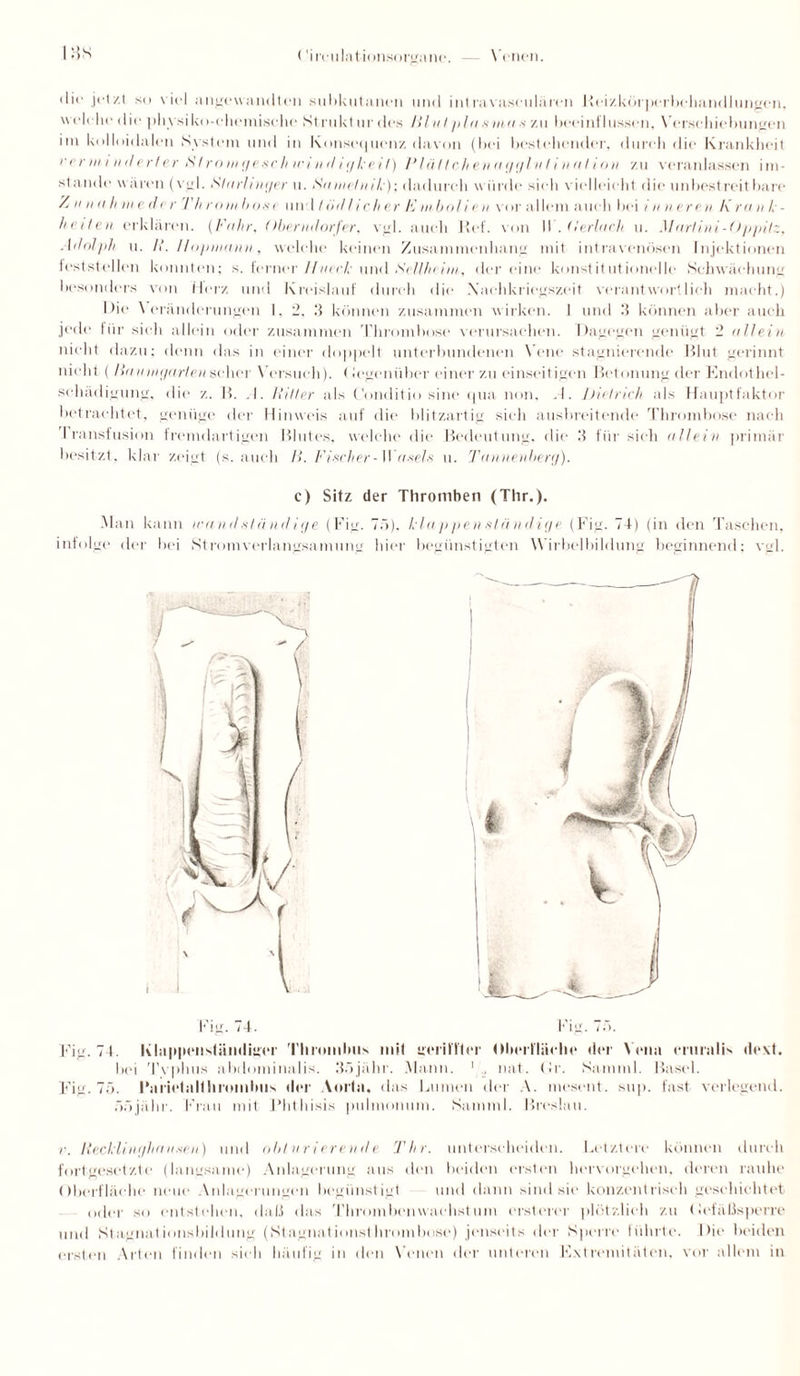ISS die jetzt so viel angewandten subkutanen und intravaseulären Keizkörperbehandlungen, wel« du* die ph vsi ko-c he mische St rukt ur des Hl nt pla sma s zu lieei nf bissen, Verschiebungen im kolloidalen System und in Konsequenz davon (bei bestellender, durch die Krankheit verminderter Nfromgesc.lt trindigkeit) Plättchenagglvfination zu veranlassen im¬ stande waren (vgl. Slttrhnger u. Sa nielnilc); dadurch würde sieh vielleicht die unbestreitbare Z u n ii li in e de r Th n> ui böse und l öd Heiter E in bolle n vor allem auch bei in n ere u K ra n /, - heilen erklären. (Fuhr, Oberndorfer, vgl. auch lief, von II .(lerlach u. Metrlini-Oppitz, Adolph u. II. Hopni-ann, welche keinen Zusammenhang mit intravenösen Injektionen feststellen konnten: s. ferner IIneck und Sellin int, der eine konstitutionelle Schwächung besonders von Herz und Kreislauf durch die .Nachkriegszeit verantwortlich macht.) Die \ Prämierungen 1. 2, 3 können zusammen w irken. 1 und 3 können aber auch jede für sieh allein oder zusammen Thrombose verursachen. Dagegen genügt 2 allein nicht dazu; denn das in einer doppelt unterbundenen Vene stagnierende Blut gerinnt nicht ( Hannujarten scher Versuch). < legeniiher einer zu einseitigen Betonung der Endothel- sehädigung, die z. B. .1. Ililter als Conditio sine qua non, A. Dietrich als Hauptfaktor betrachtet, genüge der Hinweis auf die blitzartig sieh ausbreitende Thrombose nach Iransfusion fremdartigen Blutes, welche die Bedeutung, die 3 für sieh allein primär besitzt, klar zeigt (s. auch B. Fischer - Weisels u. Tetnnenberg). c) Sitz der Thromben (Thr.). Man kann wandständige (Fig. 7ä), klappen ständige (Fig. 74) (in den Taschen, infolge der bei Stromverlangsamung hier begünstigten Wirbelbildung beginnend; vgl. \ i Fig. 74. Fig. 74. Khippenstämliger Thrombus mit gerillter Oberfläche der Vena eruralis dext. bei Tvphus abdominalis. 3ojähr. Mann. 1 nat. Cr. Samml. Basel. Fig. 75. Parietalthromlnis der Aorta, das Lumen der A. mesent. sup. fast verlegend, ööjähr. Krau mit l’hthisis pulmonum. Samml. Breslau. Recklinghausen) und obturierende Thr. unterscheiden. Letztere können durch fortgesetzte (langsame) Anlagerung aus den beiden ersten hervorgehen, deren rauhe Oberfläche neue Anlagerungen begünstigt und dann sind sie konzentrisch geschichtet oder so entstehen, daß das Thrombenwaehstum crslerer plötzlich zu Oefäßsperre und Stagnationsbildung (Stagnationsthromho.se) jenseits der Sperre führte. Die beiden ersten Arten finden sieh häufig in den Venen der unteren Extremitäten, vor allem in