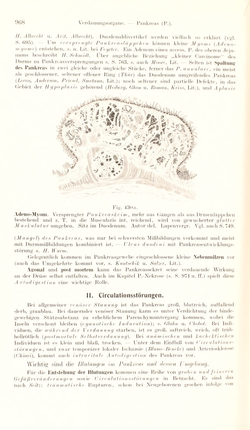 II. Albreeht ii. Arzt. Alb-recht). Duodcnaldivertikel werden vielfach so erklärt (vgl. *''• *'!);»). I m versprengte Pankrenslii ppchen können kleine Myome (Adeno- m i/ome) entstehen, s. n. Lit. hei Fei/rler. Kin Adenom eines aceess. I*. des oberen deju- nums beschreibt II. Sehmidi. ( her angebliche Beziehung „kleiner Carcinome des Darms zu Pankreasversprengungen s. S. 7t>3, s. auch Moore. Lit. Selten ist Spaltung iles Pankreas in zwei gleiche oder ungleiche Stücke, ferner das P. ann-ulnre, ein meist als geschlossener, seltener offener King (Thür) das Duodenum umgreifendes Pankreas (Lei'co, Anderson. Prieset. Smetanu, Lit.); noch seltener sind partielle Defekte, in das <lebiet der Hy poplaste gehörend (Heiberg, (Ilion u. Roman, Friss. Lit.), und Aplasie . -■ t: “.ft’,. i * *■ :ß J.' £ cz* * ; * * '• r' *** * o . ' ° o. B v 0 s . * ' ,t7 .« >> ► ®V , O.. , »«> > 0. * . * ° , » •- i * V ♦ » *- «• - ' ’ ■ •fo\ *5* ✓ 5:' X O * : ■ •> P5> Fig. 430 a. Adeno-Myoin. Versprengter Panier easkeim, mehr aus (längen als aus Drüsenläppehen bestehend und z. T. in die Muscularis int. reichend, wird von gewucherter glatter Muskula tur umgeben. Sitz im Duodenum. Autor de 1. Lupenvergr. Vgl. auch S. 749. (Mangel) des Pankreas, was nur bei schwersten Mißbildungen vorkommt und meist mit Darmmißbildungen kombiniert ist.— Virus duodeni mit Pankreasentwicklungs¬ störung s. H. Wurm. Gelegentlich kommen im Pankreasgewebe eingeschlossene kleine .Nebenmilzen vor (auch das Umgekehrte kommt vor, s. Kuntschik u. Salzer, Lit.). Agonal und post mortem kann das Pankreassekret seine verdauende Wirkung an der Drüse selbst entfalten. Auch im Kapitel P.-Nekrose (s. S. 971 u. ff.) spielt diese Autodigestion eine wichtige Rolle. II. Circulationsstörungen. Bei allgemeiner reu User Stauung ist das Pankreas groß, blutreich, auffallend derb, graublau. Bei dauernder venöser Stauung kann es unter Verdichtung der binde¬ gewebigen Stüt zsubstanz zu erheblichem Parenchym Untergang kommen, wobei die Inseln verschont bleiben (cyanotisrh r Induration); s. (Hahn u. Chobot. Bei Indi¬ viduen, die wiihrend der I erdauung starben, ist es groß, saftreich, weich, oft triib- hellrötlieh (postmortale Selbstverdauung). Bei an ihn isrhen und karhekt ischen Individuen ist es klein und blaß, trocken. Guter dem Kinfluß von ('irculations- Störungen, und zwar temporärer lokaler Ischämie (lllume-lieneke) und Arteriosklerose (Chiari), kommt auch intravitale Autodigestion des Pankreas vor. Wichtig sind die llluluntjcn im Pankreas und dessen I nujebutuj. Für die llntsfchung der Blutungen kommen eine Reihe von groben und feineren 6e jaßverün der unge n sowie ('ire ulationsstörungen in Betracht. Fs sind das nach Sr Uz; traumatisrhi Rupturen, schon bei Neugeborenen gesehen infolge von