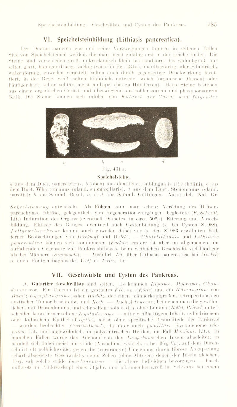 Speichelst t'illllilt lllllu. (it'scliw(iIst«* und Cvstcn des Pankreas. ‘4 SA VI. Speiclielsteinbildung (Lithiasis pancreatica). Der Ductus pancreaticus und seine Verzweigungen können in seltenen Fällen Sitz von Spcichelsteinen «erden, die man meist zufällig eist in der Leielie findet. Die Steine sind verschieden groß. mikroskopisch klein bis sandkorn bis walnußgroß, nur selten ülatt. häufiger drüsig. zackig (wie a in Fig. 131 a), maulbccrartig oder eylindriseh, walzenförmig, zuweilen verästelt, selten auch durch gegenseitige Druckwirkung facet¬ tiert. in der Regel weiß, selten braunlieh, entweder weich (organische Massen) oder häufiger hart. selten solitär, meist multipel (Dis zu Hunderten). Harle Steine bestehen aus einem organischen (•ernst mul überwiegend aus kohlensaurem und phosphorsaurem Kalk. Die Steine können sieh infolge von Katarrh ihr (liini/e und foli/indcr 1, r d Fig. 431 a. Speichelst eine. a aus dem Duet . pancreaticus. I> (oben) aus dem Duet. sublingualis (Bartholini), e aus dem Duet. Whart onianus (gland. submaxillaris). d aus dem Duet. Stenonianus (gland. parotis): h aus Samml. Basel, a r, d aus Samml. Döttingen. Autor del. Xat. (Ir. X• kri t*ta u u u <i entw ickeln. Als Folgen kann man sehen: Verödung des Drtisen- parenehyms. fibröse, gelegentlich von Regenerationsvorgängen begleitete (F. Schmitt. Bit.) Induration des Organs (eventuell Diabetes, in circa 5()0,0), Fiterung und Abseeß- bildung, Fktasie des (langes, eventuell auch (\stenbildung (s. bei Cysten S. !>88). Fi tti/i in lisiii l. rusi kommt auch zuweilen dabei vor (s. den S. !IS3 erwähnten Fall, ferner Beobachtungen von I Kerl,■hoff und Welch). <' h ol cl i I h i a .s i s und Lithiasis pancreatica können sieh kombinieren (Fuchs); ersten* ist aber im allgemeinen, im auffallenden Degensatz zur Pankrcaslithiasis, beim weiblichen Desehleeht viel häufiger als bei Männern (Sinrmands). Ausführl. LU. über Lithiasis pancreatica bei .1 hickcl; s. auch Röntgendiagnostik: Wulf u. Tictr.c. Bit. VII. Geschwülste und Cysten des Pankreas. A. (oilartige (.eseliw iil'te sind selten. Fs kommen Lipome. Mi/.rome, t'linn- dromi vor. Bin Cnieum ist ein gestieltes Fibrom (Karte) und ein //ii m a n </ iom von Huchi; 1.1/nt pli a ii </i o m > sahen llarbit:. der einen männerkopfgroßen, retroperitonealen evstisehen Tumor beschreibt, und Koch. Auch .1 ih nome. bei denen man die gewöhn¬ lichen, mit I h uscnlumina. und sehr seltene solide, d. h. ohne Lumina ( Halb I. Fra ei l) unter¬ scheiden kann ferner seltene* Kystadenome mit eiweißhaltigem Inhalt, eylindrisehem oiler kubischem Fpithel (II tipäiri), meist ohne spezifische Bestandteile des Pankreas wurden beobachtet (('< saris-l)eniel), darunter auch papilläre Kystadenome (So¬ pra na. Bit. und ungewöhnlich, in polveentrisehen Herden, im Fall Mar.iani, Bit.). In manchen Fallen wurde das Adenom von den Luni/i rhans sehen Inseln abgeleitet; es handelt sieh dabei meist um solide (Ausnahme evstiseh, s. bei II tiplrn), aut dem Durch¬ schnitt oft gol bliehw eiße. gegen die (verdrängte) l mgebung durch fibröse Abkapselung scharf abgesetzte Deschwülstc. deren Zellen (ohne Mitosen) denen der Inseln gleichen. \ irf. sah solche solide Jnsilaih nomi die ältere Individuen bevorzugen hasel- nußgroß im Pankreaskopf eines 74jähr. und pflaumenkerngroß im Schwanz hei einem