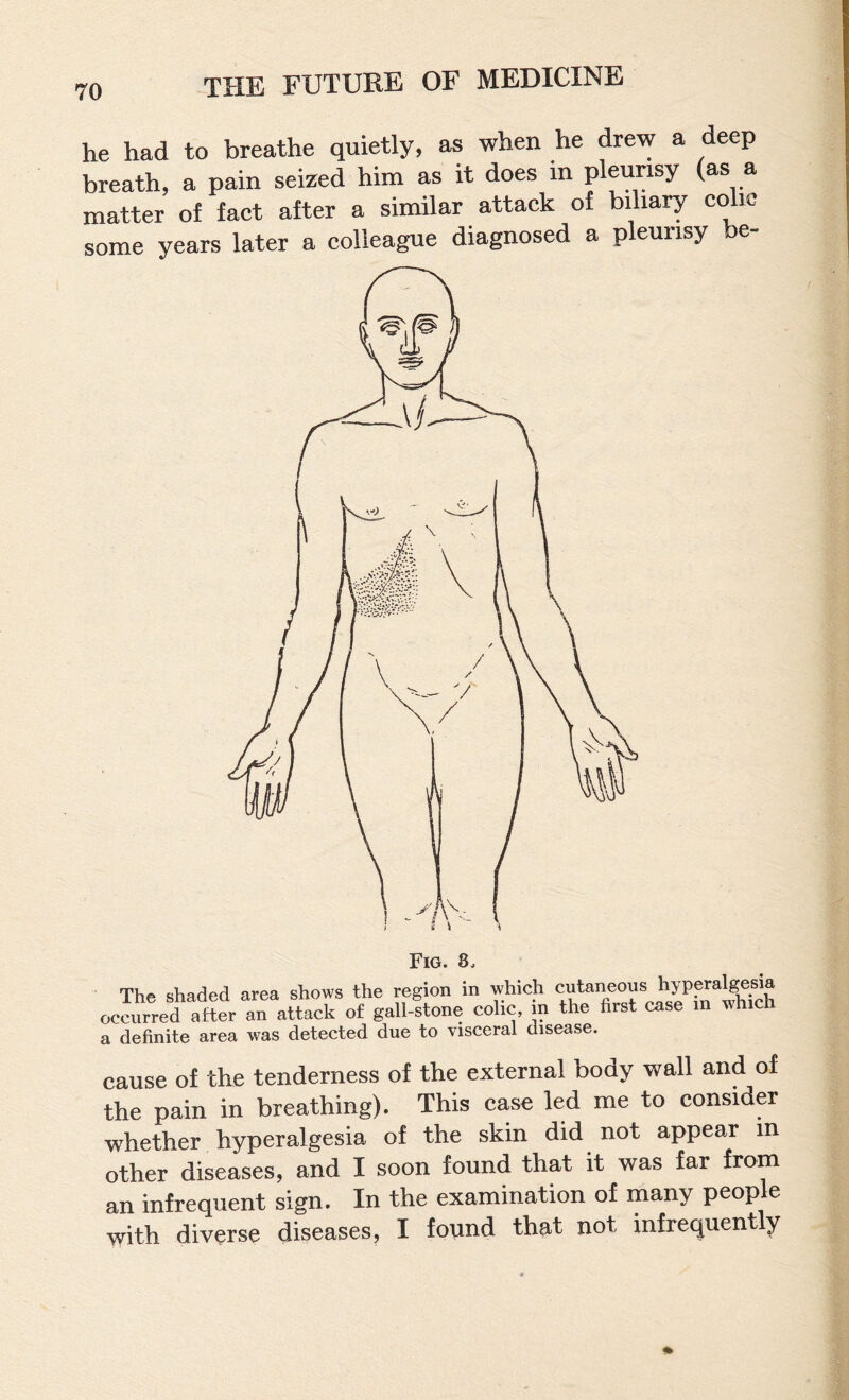 he had to breathe quietly, as when he drew a deep breath, a pain seized him as it does in pleurisy (as a matter of fact after a similar attack of biliary colic some years later a colleague diagnosed a pleurisy be- Fig. 8. The shaaea area suuws tnc xx. ..x—x* occurred after an attack of gall-stone colic, in the first case m which a definite area was detected due to visceral disease. cause of the tenderness of the external body wall and of the pain in breathing). This case led me to consider whether hyperalgesia of the skin did not appear in other diseases, and I soon found that it was far from an infrequent sign. In the examination of many people with diverse diseases, I found that not infrequently
