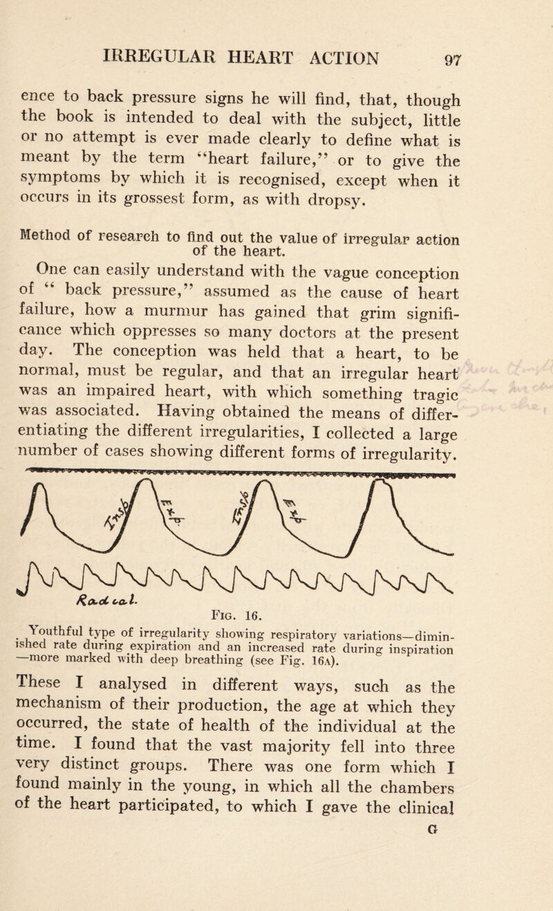 ence to back pressure signs he will find, that, though the book is intended to deal with the subject, little or no attempt is ever made clearly to define what is meant by the term ‘‘heart failure,” or to give the symptoms by which it is recognised, except when it occurs in its grossest form, as with dropsy. Method of research to find out the value of irregular action of the heart. One can easily understand with the vague conception of “ back pressure,” assumed as the cause of heart failure, how a murmur has gained that grim signifi¬ cance which oppresses so many doctors at the present day. The conception was held that a heart, to be normal, must be regular, and that an irregular heart was an impaired heart, with which something tragic v/as associated. Having obtained the means of differ¬ entiating the different irregularities, I collected a large number of cases showing different forms of irregularity. Fig. 16. Youthful type of irregularity showing respiratory variations—dimin¬ ished rate during expiration and an increased rate during inspiration —more marked with deep breathing (see Fig. 16a). These I analysed in different ways, such as the mechanism of their production, the age at which they occurred, the state of health of the individual at the time. I found that the vast majority fell into three very distinct groups. There was one form which I found mainly in the young, in which all the chambers of the heart participated, to which I gave the clinical G