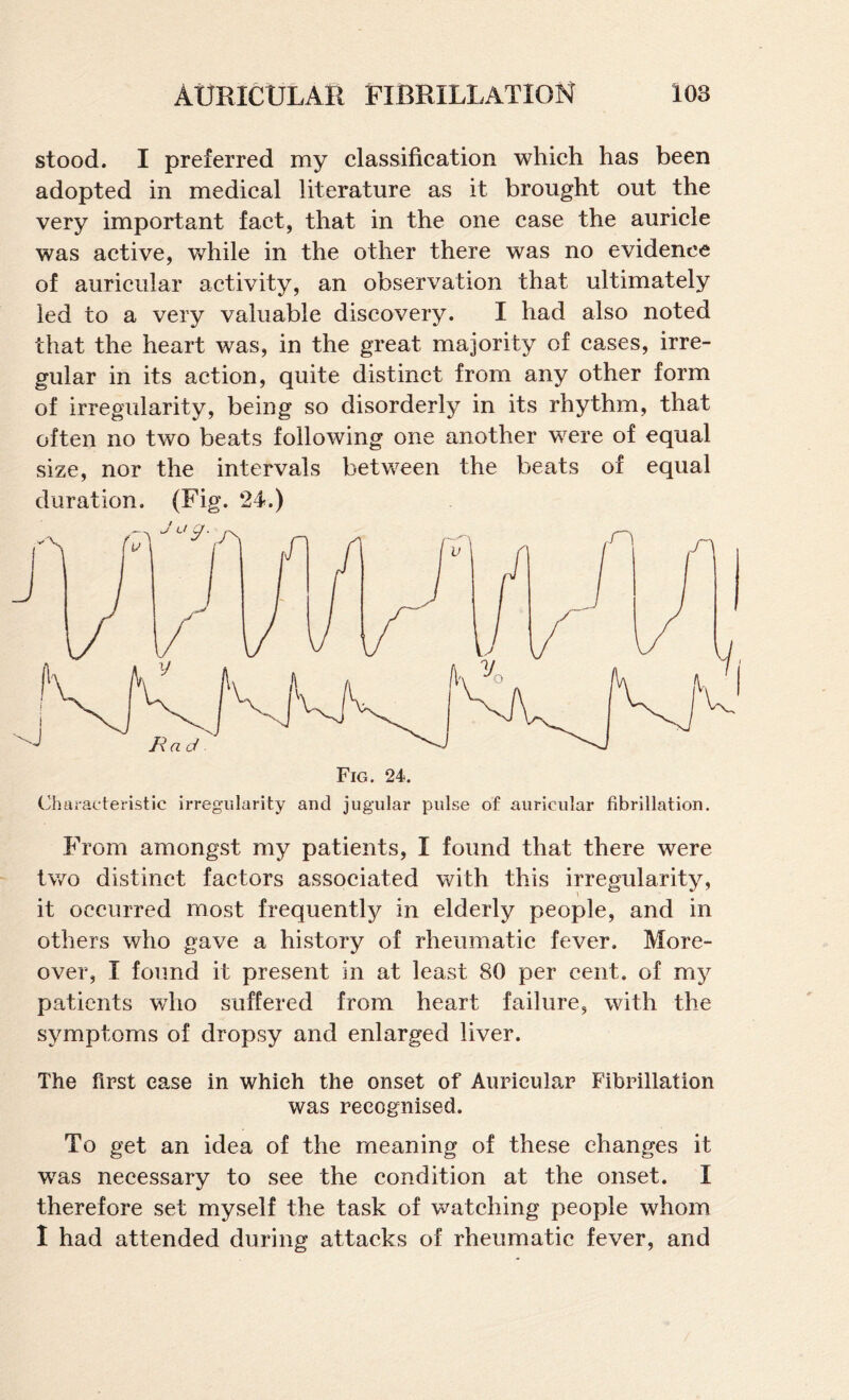 stood. I preferred my classification which has been adopted in medical literature as it brought out the very important fact, that in the one case the auricle was active, while in the other there was no evidence of auricular activity, an observation that ultimately led to a very valuable discovery. I had also noted that the heart was, in the great majority of cases, irre¬ gular in its action, quite distinct from any other form of irregularity, being so disorderly in its rhythm, that often no tv>^o beats following one another were of equal size, nor the intervals between the beats of equal duration. (Fig. 24.) Characteristic irregularity and jugular pulse of auricular fibrillation. From amongst my patients, I found that there were two distinct factors associated with this irregularity, it occurred most frequently in elderly people, and in others who gave a history of rheumatic fever. More¬ over, I found it present in at least 80 per cent, of my patients who suffered from heart failure, with the symptoms of dropsy and enlarged liver. The first ease in which the onset of Auricular Fibrillation was recognised. To get an idea of the meaning of these changes it w^as necessary to see the condition at the onset. I therefore set myself the task of watching people whom 1 had attended during attacks of rheumatic fever, and