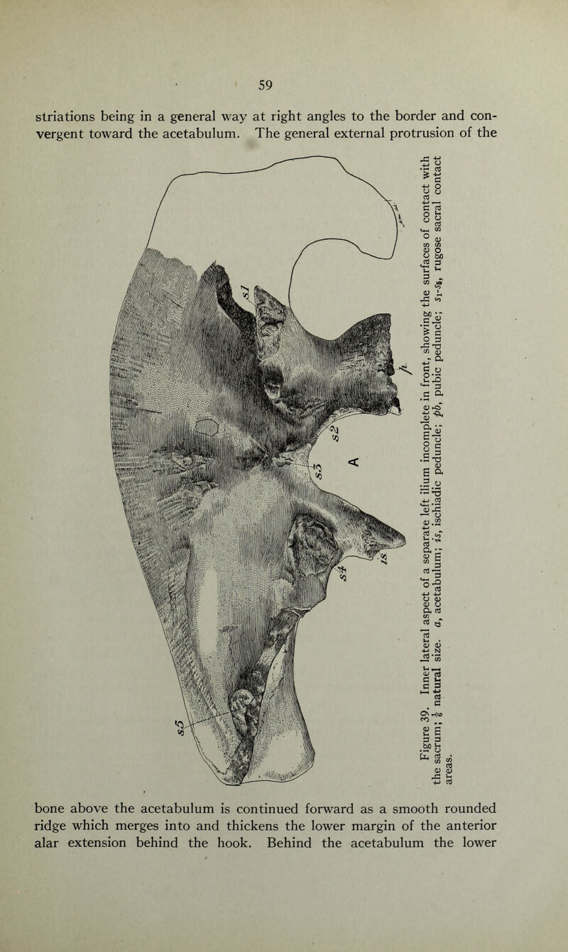 striations being in a general way at right angles to the border and con¬ vergent toward the acetabulum. The general external protrusion of the bone above the acetabulum is continued forward as a smooth rounded ridge which merges into and thickens the lower margin of the anterior alar extension behind the hook. Behind the acetabulum the lower