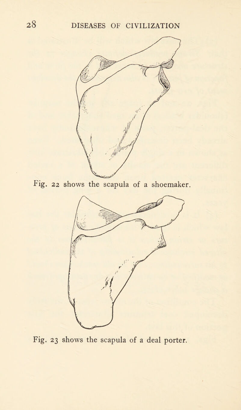 Fig. 22 shows the scapula of a shoemaker. Fig. 23 shows the scapula of a deal porter.