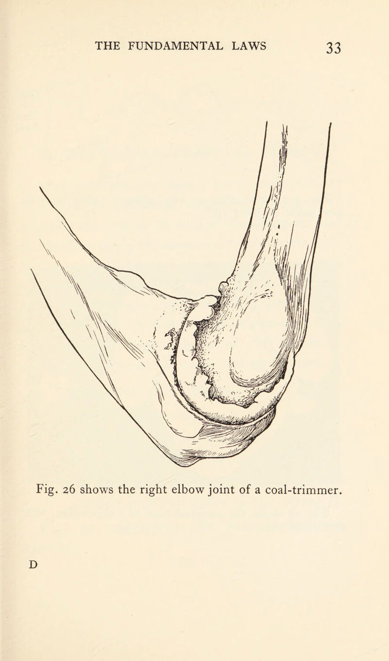 Fig. 26 shows the right elbow joint of a coal-trimmer. D