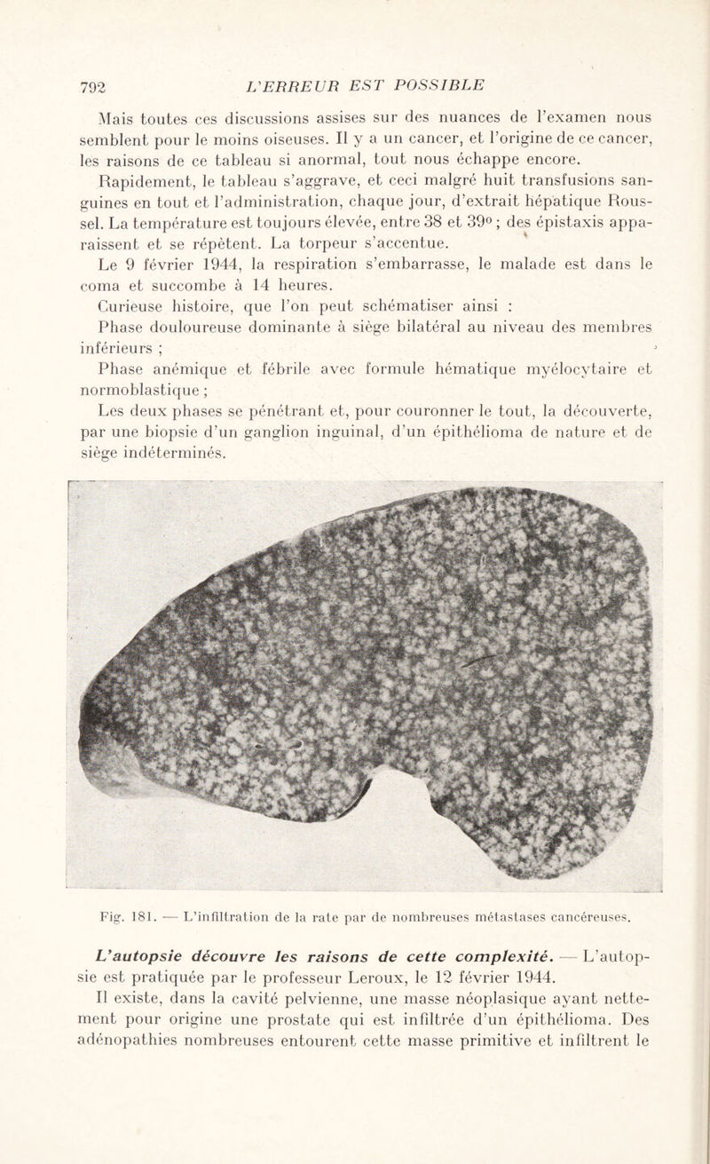 Mais toutes ces discussions assises sur des nuances de l’examen nous semblent pour le moins oiseuses. Il y a un cancer, et l’origine de ce cancer, les raisons de ce tableau si anormal, tout nous échappe encore. Rapidement, le tableau s’aggrave, et ceci malgré huit transfusions san¬ guines en tout et l’administration, chaque jour, d’extrait hépatique Rous¬ sel. La température est toujours élevée, entre 38 et 39° ; des épistaxis appa¬ raissent et se répètent. La torpeur s’accentue. Le 9 février 1944, la respiration s’embarrasse, le malade est dans le coma et succombe à 14 heures. Curieuse histoire, que l’on peut schématiser ainsi : Phase douloureuse dominante à siège bilatéral au niveau des membres inférieurs ; Phase anémique et fébrile avec formule hématique myélocytaire et normoblastique ; Les deux phases se pénétrant et, pour couronner le tout, la découverte, par une biopsie d’un ganglion inguinal, d’un épithélioma de nature et de siège indéterminés. Fig. 181. -— L’infiltration de la rate par de nombreuses métastases cancéreuses. L’autopsie découvre les raisons de cette complexité. — L'autop¬ sie est pratiquée par le professeur Leroux, le 12 février 1944. Il existe, dans la cavité pelvienne, une masse néoplasique ayant nette¬ ment pour origine une prostate qui est infiltrée d’un épithélioma. Des adénopathies nombreuses entourent cette masse primitive et infiltrent le