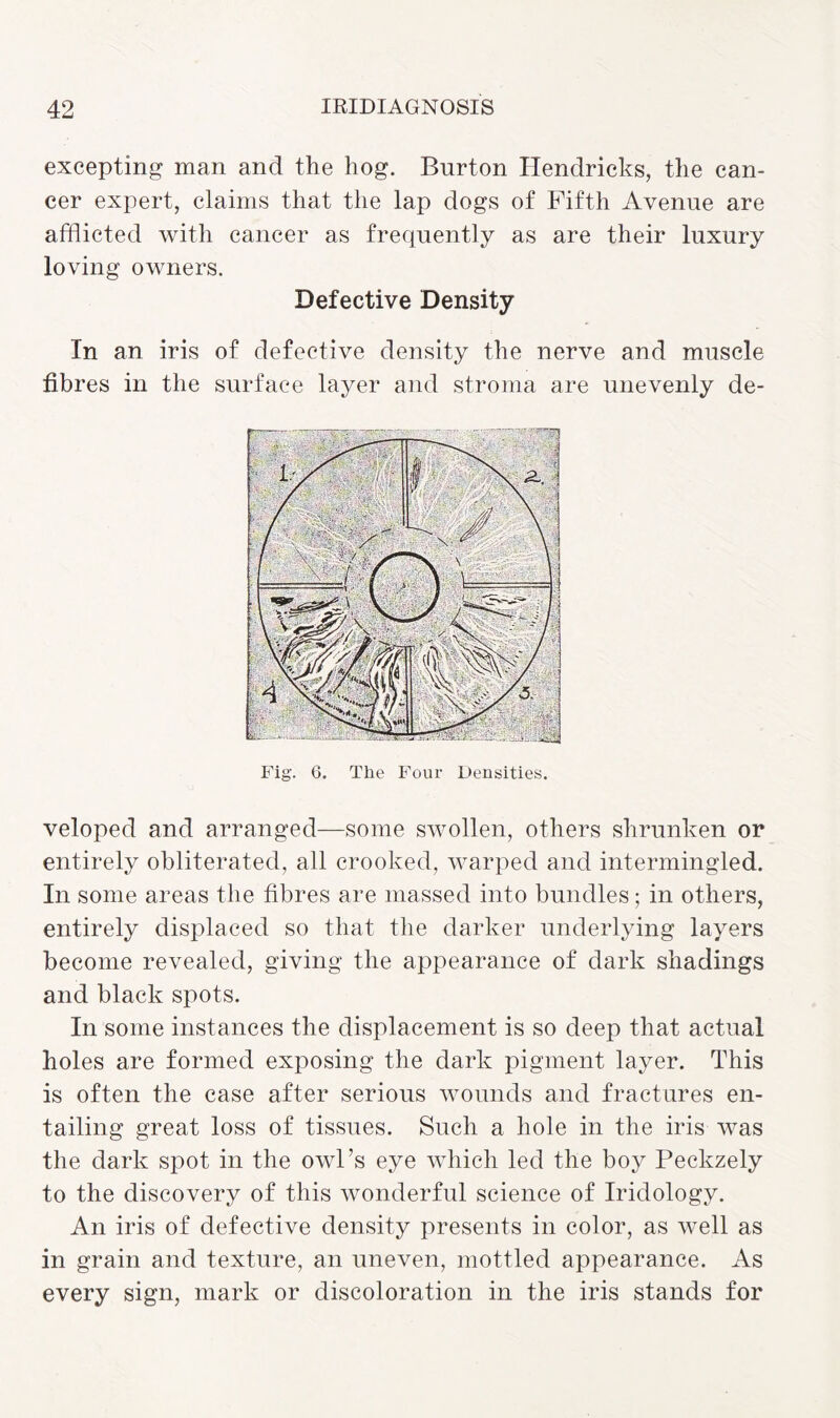 excepting man and the hog. Burton Hendricks, the can¬ cer expert, claims that the lap dogs of Fifth Avenue are afflicted with cancer as frequently as are their luxury loving owners. Defective Density In an iris of defective density the nerve and muscle fibres in the surface layer and stroma are unevenly de¬ veloped and arranged—some swollen, others shrunken or entirely obliterated, all crooked, warped and intermingled. In some areas the fibres are massed into bundles; in others, entirely displaced so that the darker underlying layers become revealed, giving the appearance of dark shadings and black spots. In some instances the displacement is so deep that actual holes are formed exposing the dark pigment layer. This is often the case after serious wounds and fractures en¬ tailing great loss of tissues. Such a hole in the iris was the dark spot in the owl’s eye which led the boy Peckzely to the discovery of this wonderful science of Iridology. An iris of defective density presents in color, as well as in grain and texture, an uneven, mottled appearance. As every sign, mark or discoloration in the iris stands for