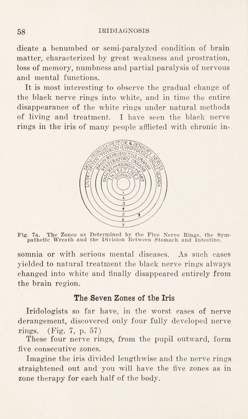dicate a benumbed or semi-paralyzed condition of brain matter, characterized by great weakness and prostration, loss of memory, numbness and partial paralysis of nervous and mental functions. It is most interesting to observe the gradual change of the black nerve rings into white, and in time the entire disappearance of the white rings under natural methods of living and treatment. I have seen the black nerve rings in the iris of many people afflicted with chronic in- Fig. 7a. The Zones as Determined by the Five Nerve Rings, the Sym¬ pathetic Wreath and the Division Between Stomach and Intestine. somnia or with serious mental diseases. As such cases yielded to natural treatment the black nerve rings always changed into white and finally disappeared entirely from the brain region. The Seven Zones of the Iris Iridologists so far have, in the worst cases of nerve derangement, discovered only four fully developed nerve rings. (Fig. 7, p. 57) These four nerve rings, from the pupil outward, form five consecutive zones. Imagine the iris divided lengthwise and the nerve rings straightened out and you will have the five zones as in zone therapy for each half of the body.