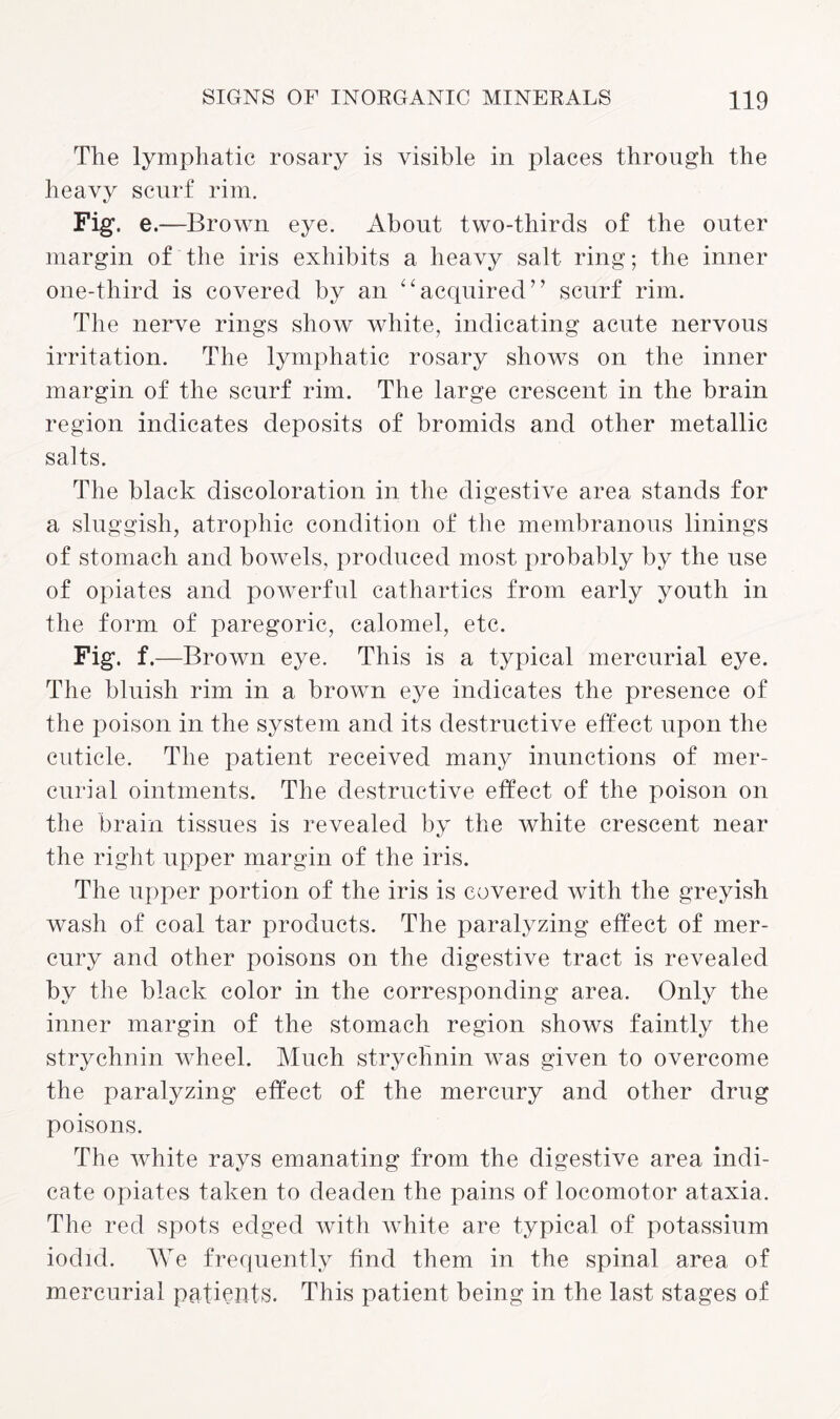 The lymphatic rosary is visible in places through the heavy scurf rim. Fig. e.—Brown eye. About two-thirds of the outer margin of the iris exhibits a heavy salt ring; the inner one-third is covered by an “acquired” scurf rim. The nerve rings show white, indicating acute nervous irritation. The lymphatic rosary shows on the inner margin of the scurf rim. The large crescent in the brain region indicates deposits of bromids and other metallic salts. The black discoloration in the digestive area stands for a sluggish, atrophic condition of the membranous linings of stomach and bowels, produced most probably by the use of opiates and powerful cathartics from early youth in the form of paregoric, calomel, etc. Fig. f .—Brown eye. This is a typical mercurial eye. The bluish rim in a brown eye indicates the presence of the poison in the system and its destructive effect upon the cuticle. The patient received many inunctions of mer¬ curial ointments. The destructive effect of the poison on the brain tissues is revealed by the white crescent near the right upper margin of the iris. The upper portion of the iris is covered with the greyish wash of coal tar products. The paralyzing effect of mer¬ cury and other poisons on the digestive tract is revealed by the black color in the corresponding area. Only the inner margin of the stomach region shows faintly the strychnin wheel. Much strychnin was given to overcome the paralyzing effect of the mercury and other drug poisons. The white rays emanating from the digestive area indi¬ cate opiates taken to deaden the pains of locomotor ataxia. The red spots edged with white are typical of potassium iodid. We frequently find them in the spinal area of mercurial patients. This patient being in the last stages of
