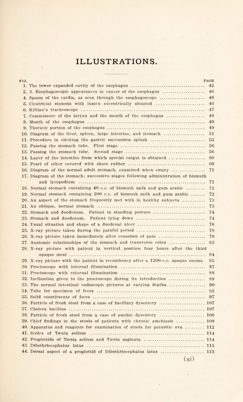 ILLUSTRATIONS. PIG. PAGE 1. The lower expanded cavity of the esophagus .. 42 2, 3. Esophagoscopic appearances in cancer of the esophagus .. 46 4. Spasm of the cardia, as seen through the esophagoscope . 46 5. Cicatricial stenosis with lumen excentrically situated . 46 6. Killian’s tracheoscope . 47 7. Commissure of the larynx and the mouth of the esophagus . 49 8. Mouth of the esophagus . 49 9. Thoracic portion of the esophagus . 49 10. Diagram of the liver, spleen, large intestine, and stomach . 51 11. Procedure in eliciting the gastric succussion splash . 53 12. Passing the stomach tube. First stage . 56 13. Passing the stomach tube. Second stage . 56 14. Layer of the intestine from which special catgut is obtained . 68 15. Pearl of ether covered with sheet rubber . 69 16. Diagram of the normal adult stomach, examined when empty . 71 17. Diagram of the stomach; successive stages following administration of bismuth and lycopodium . 71 18. Normal stomach containing 40 c.c. of bismuth milk and gum. arable . 72 19. Normal stomach containing 200 c.c. of bismuth milk and gum arabic .. 72 20. An aspect of the stomach frequently met with in healthy subjects . 73 21. An oblique, normal stomach ., 73 22. Stomach and duodenum. Patient in standing posture . 74 23. Stomach and duodenum. Patient lying down . 74 24. Usual situation and shape of a duodenal ulcer . 76 25. X-ray picture taken during the painful period . 78 26. X-ray picture taken immediately after cessation of pain ., 79 27. Anatomic relationships of the stomach and transverse colon . 83 28. X-ray picture with patient in vertical position four hours after the third opaque meal . 84 29. X-ray picture with the patient in recumbency after a 1200-e.c. opaque enema. 85 30. Proctoscope with internal illumination . 87 31. Proctoscope with external illumination . 88 32. Inclination, given to the proctoscope during its introduction . 89 33. The normal intestinal endoscopic pictures at varying depths . 90 34. Tube for specimen of feces . 92 35. Solid constituents of feces . 97 36. Particle of fresh stool from a case of bacillary dysentery . 107 37. Cholera bacillus . 107 38. Particle of fresh stool from a case of amebic dysentery . 108 39. Chief findings in the stools of patients with chronic amebiasis . 109 40. Apparatus and reagents for examination of stools for parasitic ova . 112 41. Scolex of Tænia solium . 114 42. Proglottids of Tænia solium and Tænia saginata . 114 43. Dibothriocephalus latus . 115 44. Dorsal aspect of a proglottid of Dibothriocephalus latus . 115