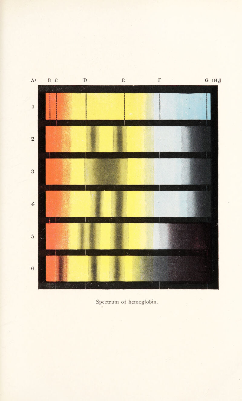 G (HJ Spectrum of hemoglobin