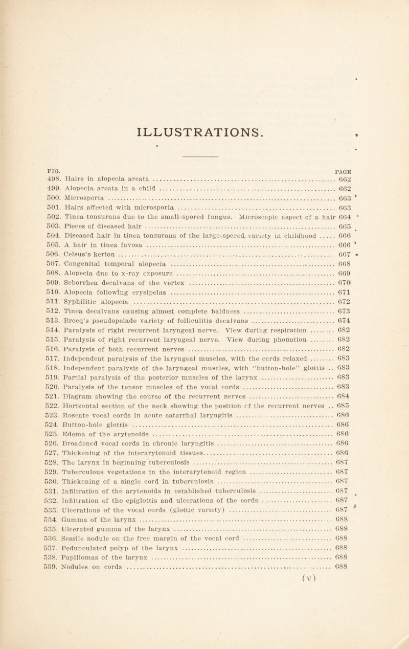 ILLUSTRATIONS FIG. PAGE 498. Hairs in alopecia areata... G62 499. Alopecia areata in a child . 662 500. Microsporia . 663 501. Hairs affected with microsporia . 663 502. Tinea tonsurans due to the small-spored fungus. Microscopic aspect of a hair 664 503. Pieces of diseased hair . 665 504. Diseased hair in tinea tonsurans of the large-spored variety in childhood.666 505. A hair in tinea favosa . 666 506. Celsus’s kerion. 667 507. Congenital temporal alopecia ..... 668 508. Alopecia due to x-ray exposure . 669 509. Seborrhea decalvans of the vertex . 670 510. Alopecia following erysipelas . 671 511. Syphilitic alopecia .. 672 512. Tinea decalvans causing almost complete baldness . 673 513. Brocq’s pseudopelade variety of folliculitis decalvans . 674 514. Paralysis of right recurrent laryngeal nerve. View during respiration . 682 515. Paralysis of right recurrent laryngeal nerve. View during phonation . 682 516. Paralysis of both recurrent nerves . 682 517. Independent paralysis of the laryngeal muscles? with the cords relaxed . 6S3 518. Independent paralysis of the laryngeal muscles, with “button-hole” glottis .. 683 519. Partial paralysis of the posterior muscles of the larynx . 683 520. Paralysis of the tensor muscles of the vocal cords . 683 521. Diagram showing the course of the recurrent nerves . 684 522. Horizontal section of the neck showing the position cf the recurrent nerves .. 685 523. Roseate vocal cords in acute catarrhal laryngitis . 686 524. Button-hole glottis . 686 525. Edema of the arytenoids . 6S6 526. Broadened vocal cords in chronic laryngitis . 686 527. Thickening of the interarytenoid tissues. 6S6 528. The larynx in beginning tuberculosis .'. 687 529. Tuberculous vegetations in the interarytenoid region ... 687 530. Thickening of a single cord in tuberculosis . 687 531. Infiltration of the arytenoids in established tuberculosis . 687 532. Infiltration of the epiglottis and ulcerations of the cords . 687 533. Ulcerations of the vocal cords (glottic variety) . 687 534. Gumma of the larynx . 688 535. Ulcerated gumma of the larynx . 688 536. Sessile nodule on the free margin of the vocal cord . 688 537. Pedunculated polyp of the larynx ...^. 688 538. Papillomas of the larynx . 688 539. Nodules on cords .. 6S8