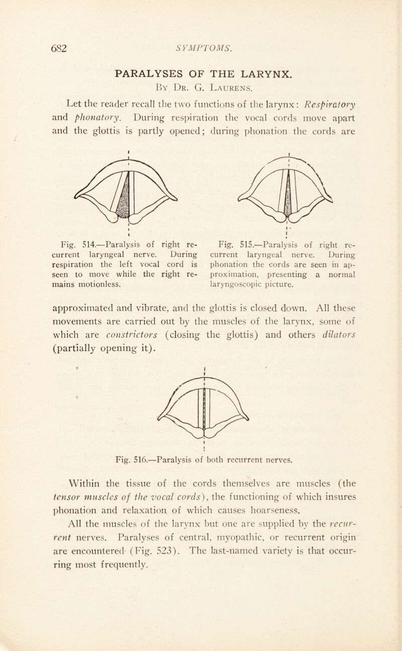 PARALYSES OF THE LARYNX. By Dr. G. Laurens. Let the reader recall the two functions of the larynx : Respiratory and phonatory. During respiration the vocal cords move apart and the glottis is partly opened ; during phonation the cords are r Fig. 514.—Paralysis of right re¬ current laryngeal nerve. During respiration the left vocal cord is seen to move while the right re¬ mains motionless. Fig. 515.—Paralysis of right re¬ current laryngeal nerve. During phonation the cords are seen in ap¬ proximation, presenting a normal laryngoscopic picture. approximated and vibrate, and the glottis is closed down. All these movements are carried out by the muscles of the larynx, some of which are constrictors (closing the glottis) and others dilators (partially opening it). i Fig. 516.—Paralysis of both recurrent nerves. Within the tissue of the cords themselves are muscles (the tensor muscles of the vocal cords), the functioning of which insures phonation and relaxation, of which causes hoarseness. All the muscles of the larynx but one are supplied by the recur¬ rent nerves. Paralyses of central, myopathic, or recurrent origin are encountered' (Fig. 523). The last-named variety is that occur¬ ring most frequently.