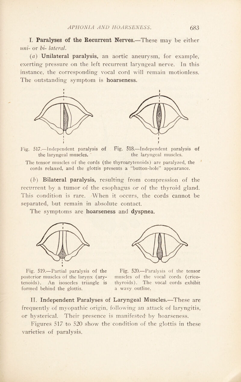 I. Paralyses of the Recurrent Nerves.—These may be either uni- or bi- lateral. (a) Unilateral paralysis, an aortic aneurysm, for example, exerting pressure on the left recurrent laryngeal nerve. In this instance, the corresponding vocal cord will remain motionless. The outstanding symptom is hoarseness. I I L I Fig. 517.—Independent paralysis of the laryngeal muscles. i Fig. 518.—Independent paralysis of the laryngeal muscles. The tensor muscles of the cords (the thyroarytenoids) are paralyzed, the cords relaxed, and the glottis presents a “button-hole” appearance. (b) Bilateral paralysis, resulting from compression of the recurrent by a tumor of the esophagus or of the thyroid gland. This condition is rare. When it occurs, the cords cannot be separated, but remain in absolute contact. The symptoms are hoarseness and dyspnea. Fig. 519.—Partial paralysis of the posterior muscles of the larynx (ary¬ tenoids). An isosceles triangle is formed behind the glottis. Fig. 520.—Paralysis of the tensor muscles of the vocal cords (crico¬ thyroids). The vocal cords exhibit a wavy outline. II. Independent Paralyses of Laryngeal Muscles.—These are frequently of myopathic origin, following' an attack of laryngitis, or hysterical. Their presence is manifested' by hoarseness. Figures 517 to 520 show the condition of the glottis in these varieties of paralysis.