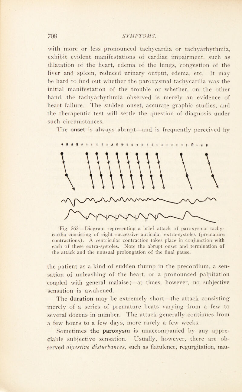 with more or less pronounced tachycardia or tachyarhythmia, exhibit evident manifestations of cardiac impairment, such as dilatation of the heart, edema of the lungs, congestion of the liver and spleen, reduced urinary output, edema, etc. ft may be hard, to find out whether the paroxysmal tachycardia was the initial manifestation of the trouble or whether, on the other hand, the tachyarhythmia observed is merely an evidence of heart failure. The sudden onset, accurate graphic studies, and the therapeutic test will settle the question of diagnosis under such circumstances. The onset is always abrupt—and is frequently perceived by • §•§<**• » I i * l r t i i i » ii ii it i | p i .* $ Fig. 562.—Diagram representing a brief attack of paroxysmal tachy¬ cardia consisting of eight successive auricular extra-systoles (premature contractions). A ventricular contraction takes place in conjunction with each of these extra-systoles. Note the abrupt onset and termination of the attack and the unusual prolongation of the final pause. the patient as a kind of sudden thump in the précordium, a sen¬ sation of unleashing of the heart, or a pronounced palpitation coupled with general malaise;—at times, however, no subjective sensation is awakened. The duration may be extremely short—the attack consisting merely of a series of premature beats varying from a few to several dozens in number. The attack generally continues from a few hours to a few days, more rarely a few weeks. Sometimes the paroxysm is unaccompanied by any appre¬ ciable subjective sensation. Usually, however, there are ob¬ served digestive disturbances, such as flatulence, regurgitation, nau-