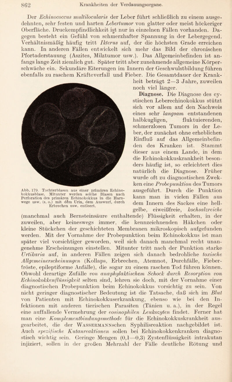 Der Echinococcus multilocularis der Leber führt schließlich zu einem ausge¬ dehnten, sehr festen und harten Lebertumor von glatter oder meist höckeriger Oberfläche. Druckempfindlichkeit ist nur in einzelnen Fällen vorhanden. Da¬ gegen besteht ein Gefühl von schmerzhafter Spannung in der Lebergegend. Verhältnismäßig häufig tritt Ikterus auf, der die höchsten Grade erreichen kann. In anderen Fällen entwickelt sich mehr das Bild der chronischen Pfortaderstauung (Aszites, Milztumor usw.). Das Allgemeinbefinden ist an¬ fangs lange Zeit ziemlich gut. Später tritt aber zunehmende allgemeine Körper¬ schwäche ein. Sekundäre Eiterungen im Innern der Geschwulstbildung führen ebenfalls zu raschem Kräfteverfall und Fieber. Die Gesamtdauer der Krank¬ heit beträgt 2 — 3 Jahre, zuweilen noch viel länger. Diagnose. Die Diagnose des cy- stischen Leberechinokokkus stützt sich vor allem auf den Nachweis eines sehr langsam entstandenen halbkugligen, fluktuierenden, schmerzlosen Tumors in der Le¬ ber, der zunächst ohne erheblichen Einfluß auf das Allgemeinbefin¬ den des Kranken ist. Stammt dieser aus einem Lande, in dem die Echinokokkuskrankheit beson¬ ders häufig ist, so erleichtert dies natürlich die Diagnose. Früher wurde oft zu diagnostischen Zwek- ken eine Probepunktion des Tumors ausgeführt. Durch die Punktion kann man in vielen Fällen aus dem Innern des Sackes eine hell¬ gelbe, eiweißfreie, kochsalzreiche (manchmal auch Bernsteinsäure enthaltende) Flüssigkeit erhalten, in der zuweilen, aber keineswegs immer, die kennzeichnenden Häkchen oder kleine Stückchen der geschichteten Membranen mikroskopisch aufgefunden werden. Mit der Vornahme der Probepunktion beim Echinokokkus ist man später viel vorsichtiger geworden, weil sich danach manchmal recht unan¬ genehme Erscheinungen einstellen. Mitunter tritt nach der Punktion starke Urtikaria auf, in anderen Fällen zeigen sich danach bedrohliche toxische Allgemeinerscheinungen (Kollaps, Erbrechen, Atemnot, Durchfälle, Fieber¬ fröste, epileptiforme Anfälle), die sogar zu einem raschen Tod führen können. Obwohl derartige Zufälle von anaphylaktischem Schock durch Resorption von Echinokokkenflüssigkeit selten sind, lehren sie doch, mit der Vornahme einer diagnostischen Probepunktion beim Echinokokkus vorsichtig zu sein. Von nicht geringer diagnostischer Bedeutung ist die Tatsache, daß sich im Blut von Patienten mit Echinokokkuserkrankung, ebenso wie bei den In¬ fektionen mit anderen tierischen Parasiten (Tänien u. a.), in der Regel eine auffallende Vermehrung der eosinophilen Leukozyten findet. Ferner hat man eine Komplementbindungsmethode für die Echinokokkuskrankheit aus¬ gearbeitet, die der WASSERMANNschen Syphilisreaktion nachgebildet ist. Auch spezifische Kutanreaktionen sollen bei Echinokokkenkranken diagno¬ stisch wichtig sein. Geringe Mengen (0,1—0,3) Zystenflüssigkeit intrakutan injiziert, sollen in der großen Mehrzahl der Fälle deutliche Rötung und Abb. 179. Tochterblasen aus einer primären Echino¬ kokkusblase. Mitunter werden solche Blasen nach Perforation des primären Echinokokkus in die Harn¬ wege usw. (s. o.) mit dSm Urin, dem Auswurf, durch Erbrechen usw. entleert.