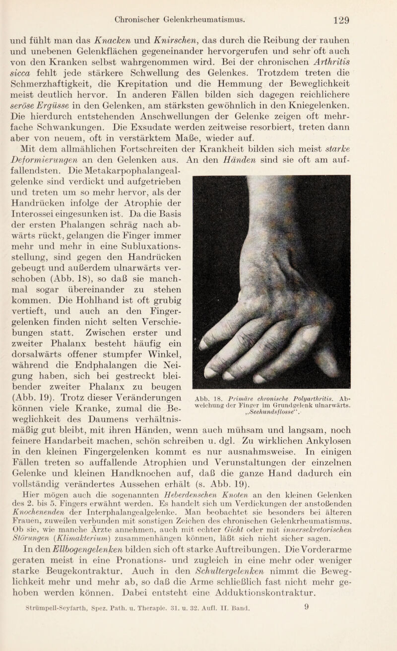 und fühlt man das Knacken und Knirschen, das durch die Reibung der rauhen und unebenen Gelenkflächen gegeneinander hervorgerufen und sehr oft auch von den Kranken selbst wahrgenommen wird. Bei der chronischen Arthritis sicca fehlt jede stärkere Schwellung des Gelenkes. Trotzdem treten die Schmerzhaftigkeit, die Krepitation und die Hemmung der Beweglichkeit meist deutlich hervor. In anderen Fällen bilden sich dagegen reichlichere seröse Ergüsse in den Gelenken, am stärksten gewöhnlich in den Kniegelenken. Die hierdurch entstehenden Anschwellungen der Gelenke zeigen oft mehr¬ fache Schwankungen. Die Exsudate werden zeitweise resorbiert, treten dann aber von neuem, oft in verstärktem Maße, wieder auf. Mit dem allmählichen Fortschreiten der Krankheit bilden sich meist starke Deformierungen an den Gelenken aus. An den Händen sind sie oft am auf¬ fallendsten. Die Metakarpophalangeal- gelenke sind verdickt und aufgetrieben und treten um so mehr hervor, als der Handrücken infolge der Atrophie der Interossei eingesunken ist. Da die Basis der ersten Phalangen schräg nach ab¬ wärts rückt, gelangen die Finger immer mehr und mehr in eine Subluxations¬ stellung, sind gegen den Handrücken gebeugt und außerdem ulnarwärts ver¬ schoben (Abb. 18), so daß sie manch¬ mal sogar übereinander zu stehen kommen. Die Hohlhand ist oft grubig vertieft, und auch an den Finger - gelenken finden nicht selten Verschie¬ bungen statt. Zwischen erster und zweiter Phalanx besteht häufig ein dorsalwärts offener stumpfer Winkel, während die Endphalangen die Nei¬ gung haben, sich bei gestreckt blei¬ bender zweiter Phalanx zu beugen (Abb. 19). Trotz dieser Veränderungen können viele Kranke, zumal die Be¬ weglichkeit des Daumens verhältnis¬ mäßig gut bleibt, mit ihren Händen, wenn auch mühsam und langsam, noch feinere Handarbeit machen, schön schreiben u. dgl. Zu wirklichen Ankylosen in den kleinen Fingergelenken kommt es nur ausnahmsweise. In einigen Fällen treten so auffallende Atrophien und Verunstaltungen der einzelnen Gelenke und kleinen Handknochen auf, daß die ganze Hand dadurch ein vollständig verändertes Aussehen erhält (s. Abb. 19). Hier mögen auch die sogenannten Heberdenschen Knoten an den kleinen Gelenken des 2. bis 5. Fingers erwähnt werden. Es handelt sich um Verdickungen der anstoßenden Knochenenden der Interphalangealgelenke. Man beobachtet sie besonders bei älteren Frauen, zuweilen verbunden mit sonstigen Zeichen des chronischen Gelenkrheumatismus. Ob sie, wie manche Ärzte annehmen, auch mit echter Gicht oder mit innersekretorischen Störungen (Klimakterium) Zusammenhängen können, läßt sich nicht sicher sagen. In den Ellbogengelenken bilden sich oft starke Auftreibungen. Die Vorderarme geraten meist in eine Pronations- und zugleich in eine mehr oder weniger starke Beugekontraktur. Auch in den Schulter gelenken nimmt die Beweg¬ lichkeit mehr und mehr ab, so daß die Arme schließlich fast nicht mehr ge¬ hoben werden können. Dabei entsteht eine Adduktionskontraktur. Strtimpell-Seyfarth, Spez. Path. u. Therapie. 31. u. 32. Aufl. II. Band. 9 Abb. 18. Primäre chronische Polyarthritis. Ab¬ weichung der Finger im Grundgelenk ulnarwärts. „Seehundsflosse’’ ‘.