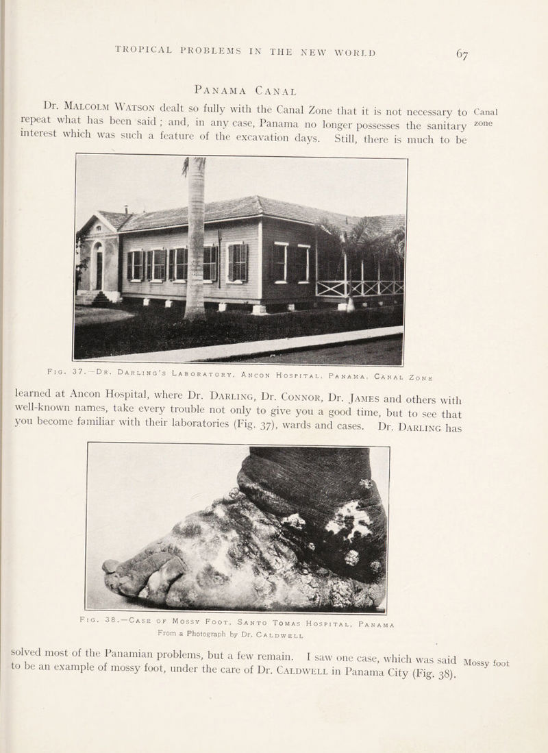 Panama Canal I)i. Malcolm Watson dealt so fully with the Canal Zone that it is not necessary to Canal lepeat what has been said; and, in any case, Panama no longer possesses the sanitary zone nterest which was such a feature of the excavation days. Still, there is much to be learned at Ancon Hospital, where Dr. Darling, Dr. Connor, Dr. James and others with well-known names, take every trouble not only to give you a good time, but to see that you become familiar with their laboratories (Fig. 37), wards and cases. Dr. Darling has From a Photograph by Dr. Caldwell solved most of the Panamian problems, but a few remain. I saw one case, which was said Mossy foot to be an example of mossy foot, under the care of Dr. Caldwell in Panama City (Fig. 38).