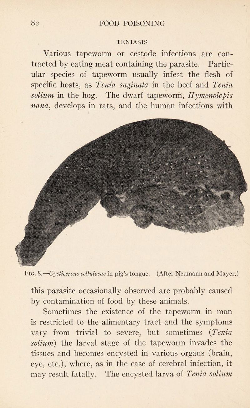 TENIASIS Various tapeworm or cestode infections are con¬ tracted by eating meat containing the parasite. Partic¬ ular species of tapeworm usually infest the flesh of specific hosts, as Tenia saginata in the beef and Tenia solium in the hog. The dwarf tapeworm, Hymenolepis nana, develops in rats, and the human infections with Fig. 8.—Cysticercus cellulosae in pig’s tongue. (After Neumann and Mayer.) this parasite occasionally observed are probably caused by contamination of food by these animals. Sometimes the existence of the tapeworm in man is restricted to the alimentary tract and the symptoms vary from trivial to severe, but sometimes (Tenia solium) the larval stage of the tapeworm invades the tissues and becomes encysted in various organs (brain, eye, etc.), where, as in the case of cerebral infection, it may result fatally. The encysted larva of Tenia solium