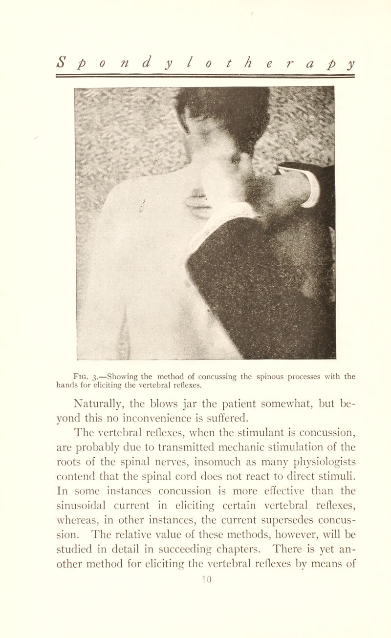 Fig. 3.—Showing the method of concussing the spinous processes with the hands for eliciting the vertebral reflexes. Naturally, the blows jar the patient somewhat, but be¬ yond this no inconvenience is suffered. The vertebral reflexes, when the stimulant is concussion, are probably due to transmitted mechanic stimulation of the roots of the spinal nerves, insomuch as many physiologists contend that the spinal cord does not react to direct stimuli. In some instances concussion is more effective than the sinusoidal current in eliciting certain vertebral reflexes, whereas, in other instances, the current supersedes concus¬ sion. The relative value of these methods, however, will be studied in detail in succeeding chapters. There is yet an¬ other method for eliciting the vertebral reflexes by means of