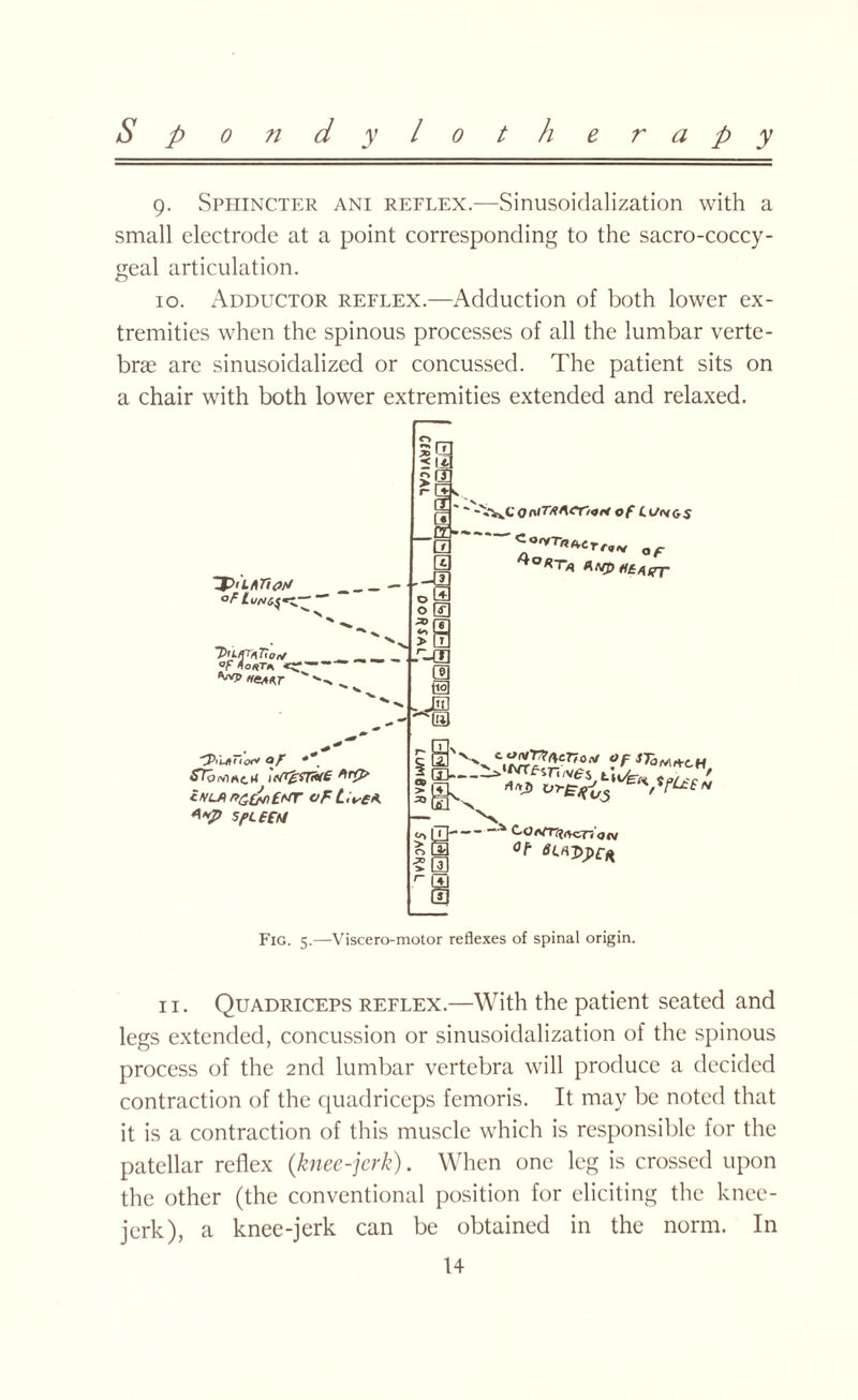 9. Sphincter ani reflex.—Sinusoidalization with a small electrode at a point corresponding to the sacro-coccy- geal articulation. 10. Adductor reflex.—Adduction of both lower ex¬ tremities when the spinous processes of all the lumbar verte¬ brae are sinusoidalized or concussed. The patient sits on a chair with both lower extremities extended and relaxed. °f ——— ne*<(T v ^ ~3><'l4uo<o af iNLf\r?£&)£nr oF Lire* SpLEfU > 3 'm a i-s 0a O [£] fffl r-co a .M ‘ -Vv^c <7 nlTA/\CY/Ori of L t/<y & 5 l0'vr',*er'<”v CE—^‘^Csr;<v^5 . / g-— COfVT-(?<vc7-( <j<v Is <“ a fin Fig. 5.—Visceromotor reflexes of spinal origin. 11. Quadriceps reflex.—With the patient seated and legs extended, concussion or sinusoidalization of the spinous process of the 2nd lumbar vertebra will produce a decided contraction of the quadriceps femoris. It may be noted that it is a contraction of this muscle which is responsible for the patellar reflex (knee-jerk). When one leg is crossed upon the other (the conventional position for eliciting the knee- jerk), a knee-jerk can be obtained in the norm. In