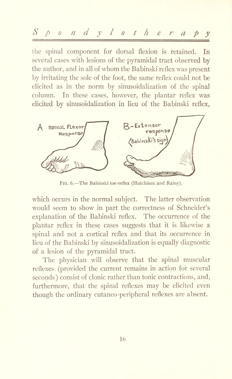 (he spinal component for dorsal flexion is retained. In several cases with lesions of the pyramidal tract observed by the author, and in all of whom the Babinski reflex was present by irritating the sole of the foot, the same reflex could not be elicited as in the norm by sinusoidalization of the spinal column. In these cases, however, the plantar reflex was elicited by sinusoidalization in lieu of the Babinski reflex, Fig. 6.—The Babinski toe-reflex (Hutchison and Rainy). which occurs in the normal subject. The latter observation would seem to show in part the correctness of Schneider’s explanation of the Babinski reflex. The occurrence of the plantar reflex in these cases suggests that it is likewise a spinal and not a cortical reflex and that its occurrence in lieu of the Babinski by sinusoidalization is equally diagnostic of a lesion of the pyramidal tract. The physician will observe that the spinal muscular reflexes (provided the current remains in action for several seconds) consist of clonic rather than tonic contractions, and, furthermore, that the spinal reflexes may be elicited even though the ordinary cutaneo-peripheral reflexes are absent.