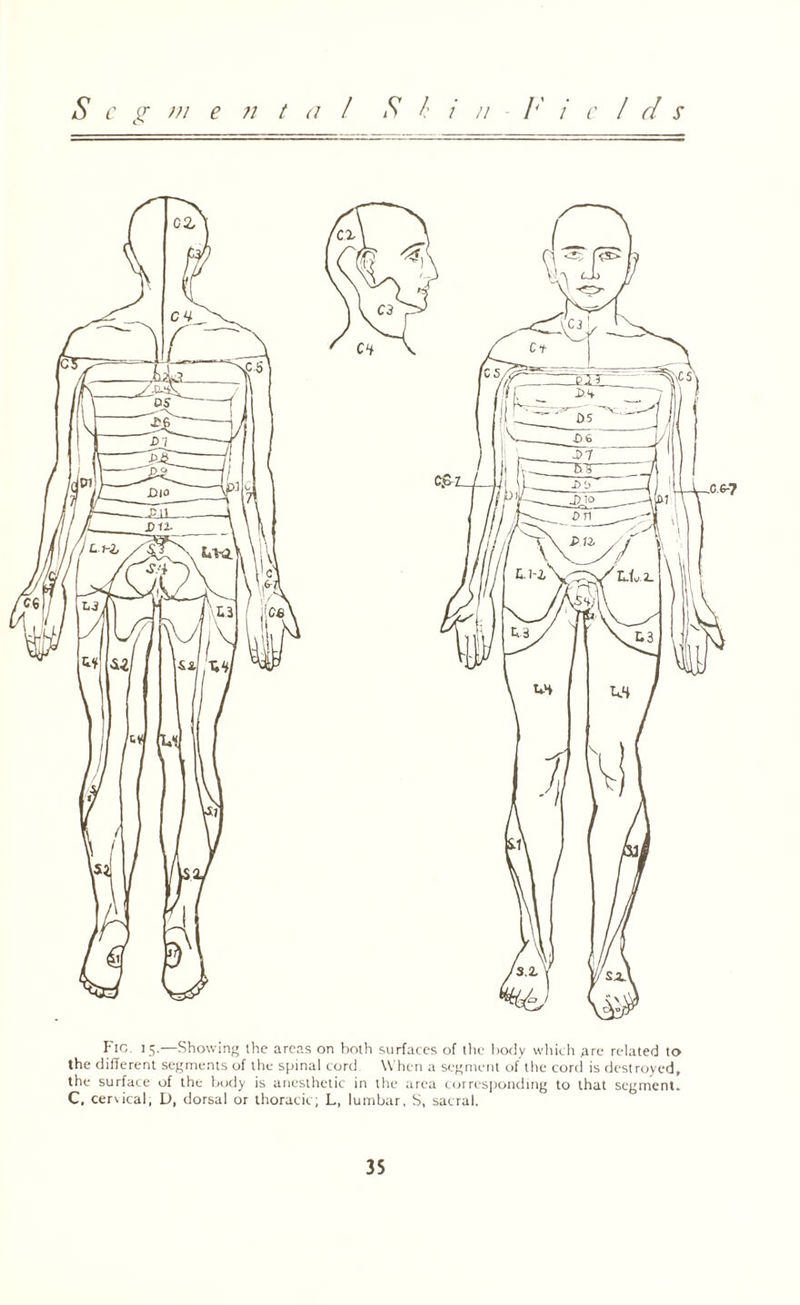 S c g m e ?i t a / S l / // - /'' / elds Fie. 15.—Showing the areas on both surfaces of the body which are related to the different segments of the spinal cord When a segment of the cord is destroyed, the surface of the body is anesthetic in the area corresponding to that segment. C, cervical, D, dorsal or thoracic; L, lumbar, S, sacral.