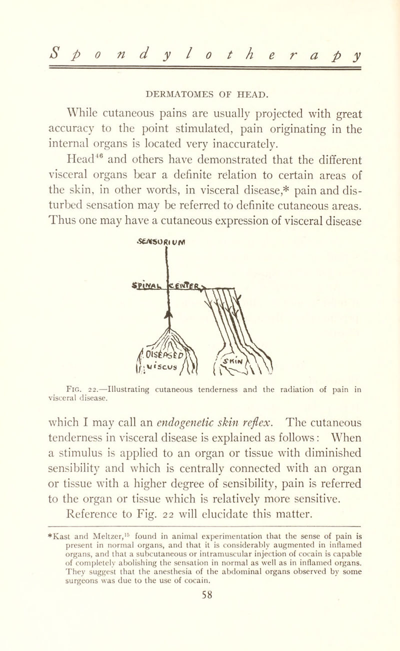 DERMATOMES OF HEAD. While cutaneous pains are usually projected with great accuracy to the point stimulated, pain originating in the internal organs is located very inaccurately. Head16 and others have demonstrated that the different visceral organs bear a definite relation to certain areas of the skin, in other words, in visceral disease* pain and dis¬ turbed sensation may be referred to definite cutaneous areas. Thus one may have a cutaneous expression of visceral disease .stNsoRi vn\ Fig. 22.—Illustrating cutaneous tenderness and the radiation of pain in visceral disease. which I may call an endogenetic skin reflex. The cutaneous tenderness in visceral disease is explained as follows: When a stimulus is applied to an organ or tissue with diminished sensibility and which is centrally connected with an organ or tissue with a higher degree of sensibility, pain is referred to the organ or tissue which is relatively more sensitive. Reference to Fig. 22 will elucidate this matter. *Kast and Meltzer,15 found in animal experimentation that the sense of pain is present in normal organs, and that it is considerably augmented in inflamed organs, and that a subcutaneous or intramuscular injection of cocain is capable of completely abolishing the sensation in normal as well as in inflamed organs. They suggest that the anesthesia of the abdominal organs observed by some surgeons was due to the use of cocain.