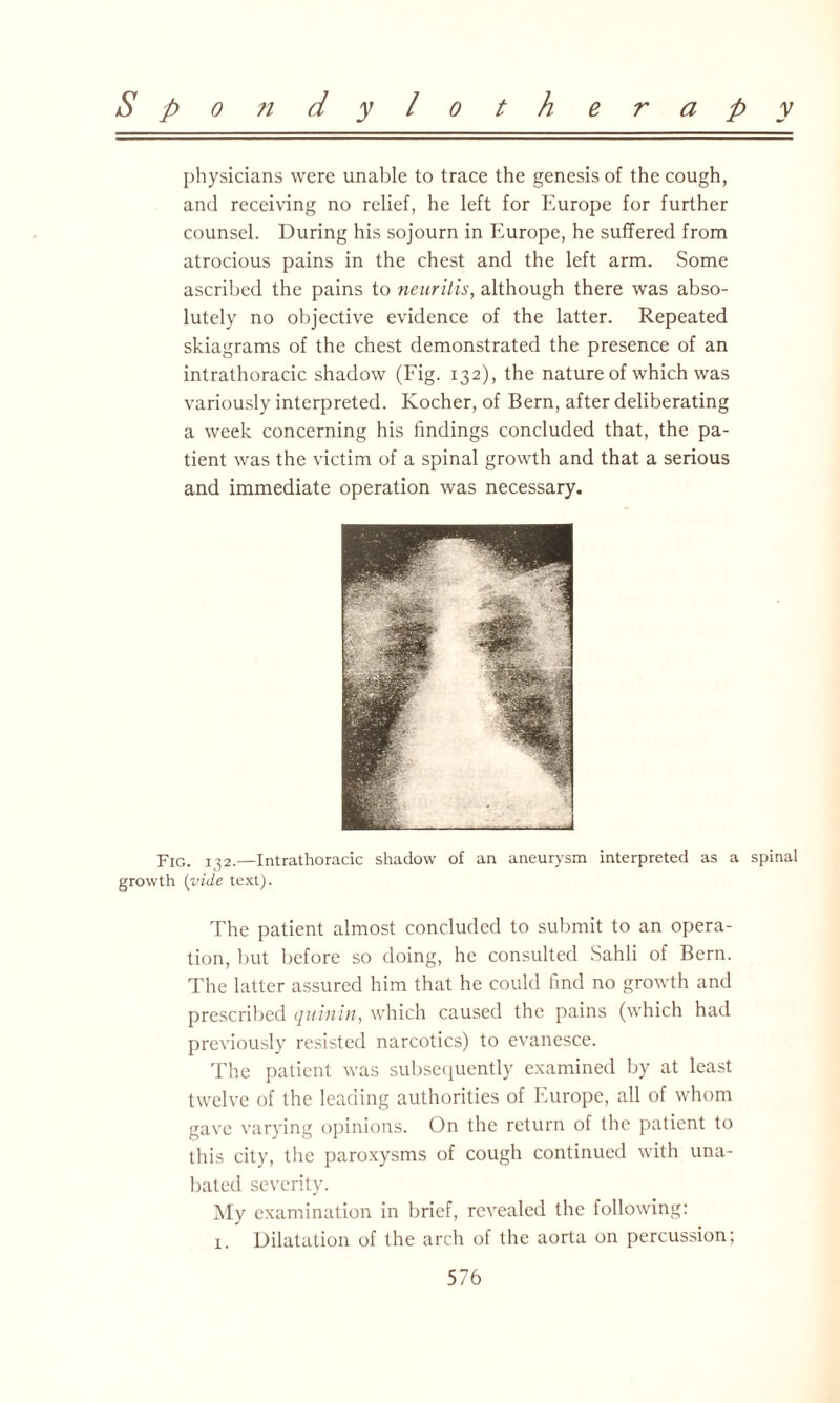 physicians were unable to trace the genesis of the cough, and receiving no relief, he left for Europe for further counsel. During his sojourn in Europe, he suffered from atrocious pains in the chest and the left arm. Some ascribed the pains to neuritis, although there was abso¬ lutely no objective evidence of the latter. Repeated skiagrams of the chest demonstrated the presence of an intrathoracic shadow (Fig. 132), the nature of which was variously interpreted. Kocher, of Bern, after deliberating a week concerning his findings concluded that, the pa¬ tient was the victim of a spinal growth and that a serious and immediate operation was necessary. Fig. 132.—Intrathoracic shadow of an aneurysm interpreted as a spinal growth (vide text). The patient almost concluded to submit to an opera¬ tion, but before so doing, he consulted Sahli of Bern. The latter assured him that he could find no growth and prescribed quinin, which caused the pains (which had previously resisted narcotics) to evanesce. The patient was subsequently examined by at least twelve of the leading authorities of Europe, all of whom gave varying opinions. On the return of the patient to this city, the paroxysms of cough continued with una¬ bated severity. My examination in brief, revealed the following: 1. Dilatation of the arch of the aorta on percussion;