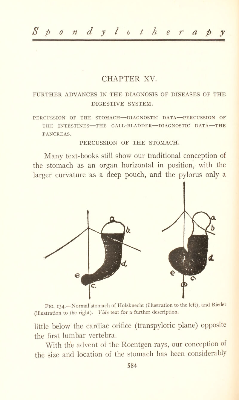 CHAPTER XV. FURTHER ADVANCES IN THE DIAGNOSIS OF DISEASES OF THE DIGESTIVE SYSTEM. PERCUSSION OF THE STOMACH—DIAGNOSTIC DATA—PERCUSSION OF THE INTESTINES—THE GALL-BLADDER—DIAGNOSTIC DATA—THE PANCREAS. PERCUSSION OF THE STOMACH. Many text-books still show our traditional conception of the stomach as an organ horizontal in position, with the larger curvature as a deep pouch, and the pylorus only a Fig. 134.—Normal stomach of Holzknecht (illustration to the left), and Rieder (illustration to the right). Vide text for a further description. little below the cardiac orifice (transpyloric plane) opposite the first lumbar vertebra. With the advent of the Roentgen rays, our conception of the size and location of the stomach has been considerably