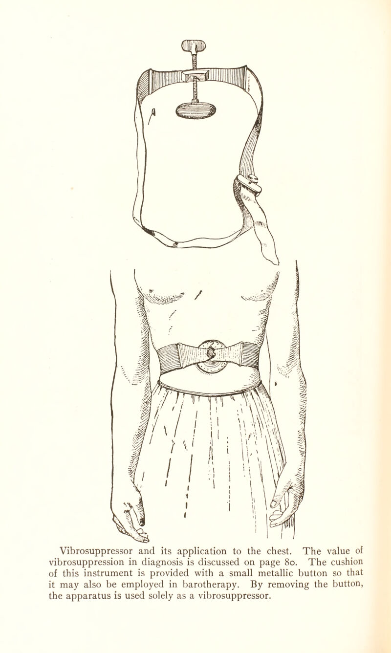 Vibrosuppressor and its application to the chest. The value of vibrosuppression in diagnosis is discussed on page 80. The cushion of this instrument is provided with a small metallic button so that it may also be employed in barotherapy. By removing the button, the apparatus is used solely as a vibrosuppressor.