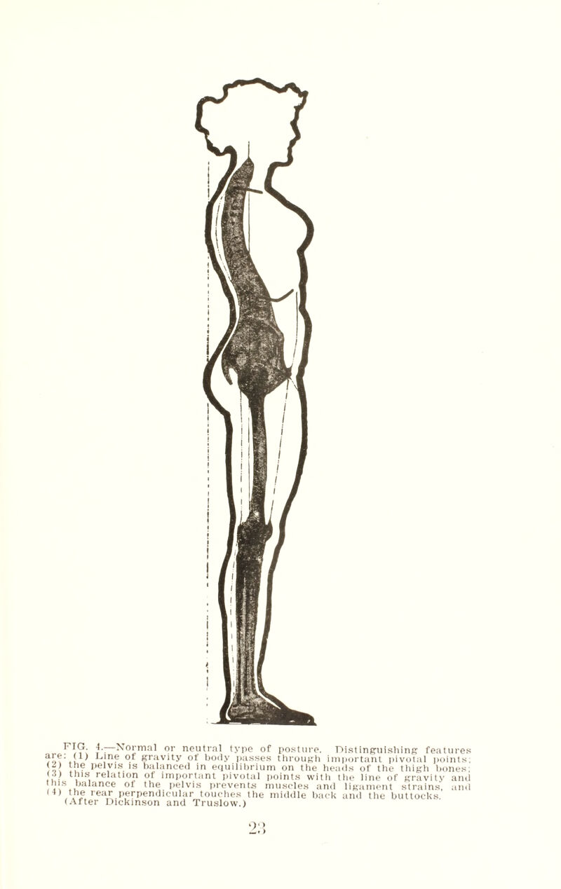 r'lG. 4.- Normal or neutral type of posture. Distinguishing features ,nP gravity of body passes through important pivotal points; * pelvis is balanced in equilibrium on the heads of the thigh bones; (4) this relation of important pivotal points with tlie line of gravity and , < Is. *ja*ance of the jielvis prevents muscles and ligament strains, and (4) the rear perpendicuhir touches the middle back and the buttocks. (After Dickinson and Truslow.) 2:’,