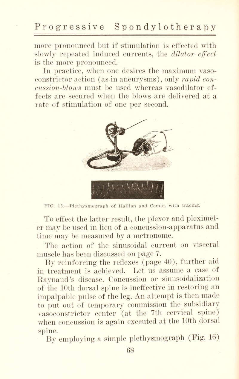 more pronounced but if stimulation is effected with slowly repeated induced currents, the dilator effect is the more pronounced. In practice, when one desires the maximum vaso¬ constrictor action (as in aneurysms), only rapid con¬ cussion-blows must be used whereas vasodilator ef¬ fects are secured when the blows are delivered at a rate of stimulation of one per second. FIG. 16.—PlethysmG graph of Hallion and Comte, with tracing. To effect the latter result, the plexor and pleximet- er may be used in lieu of a concussion-apparatus and time may be measured by a metronome. The action of the sinusoidal current on visceral muscle has been discussed on page 7. By reinforcing the reflexes (page 40), further aid in treatment is achieved. Let us assume a case of Raynaud’s disease. Concussion or sinusoidalization of the 10th dorsal spine is ineffective in restoring an impalpable pulse of the leg. An attempt is then made to put out of temporary commission the subsidiary vasoconstrictor center (at the 7th cervical spine) when concussion is again executed at the 10th dorsal spine. By employing a simple plethysmograph (Fig. 10)