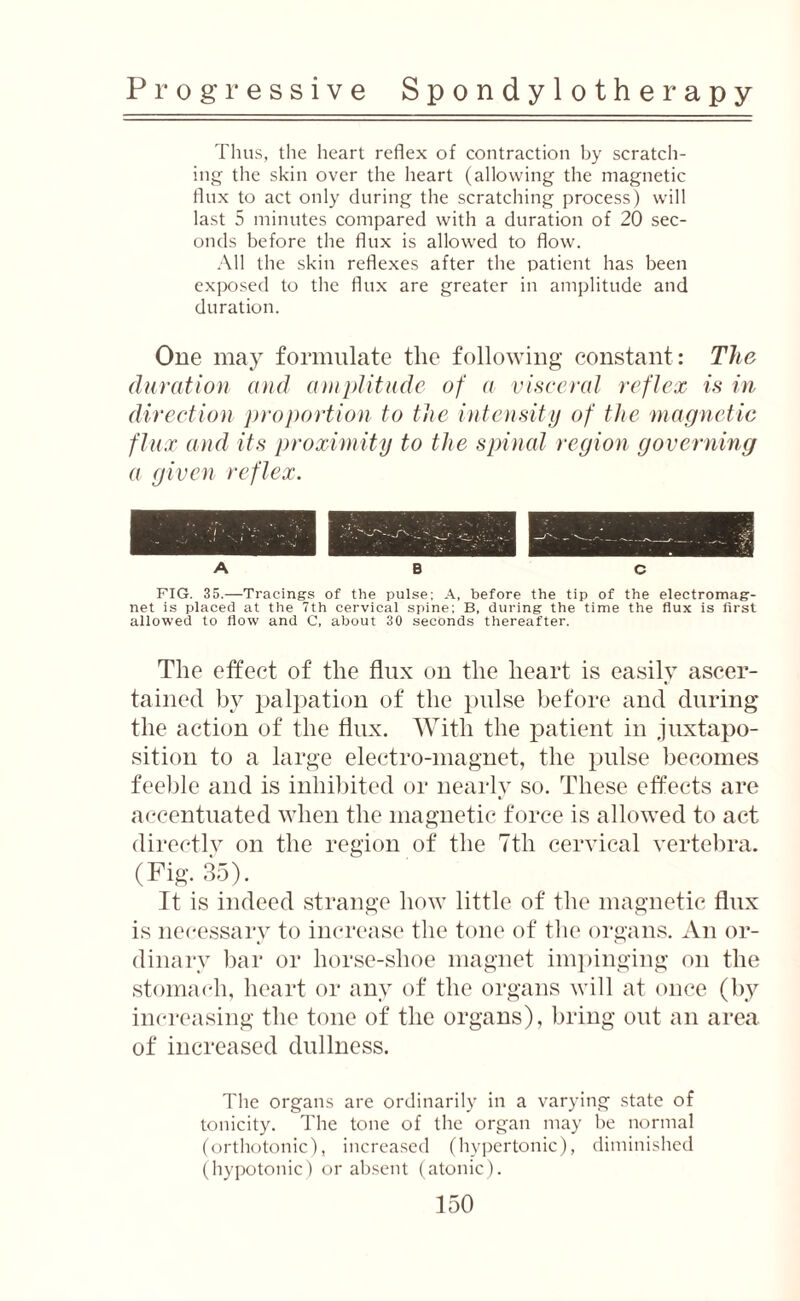 Thus, the heart reflex of contraction by scratch¬ ing the skin over the heart (allowing the magnetic flux to act only during the scratching process) will last 5 minutes compared with a duration of 20 sec¬ onds before the flux is allowed to flow. All the skiu reflexes after the patient has been exposed to the flux are greater in amplitude and duration. One may formulate the following constant: The duration and amplitude of a visceral reflex is in direction proportion to the intensity of the magnetic flux and its proximity to the spinal region governing a given reflex. A B c FIG. 35.—Tracings of the pulse: A, before the tip of the electromag¬ net is placed at the 7th cervical spine; B, during the time the flux is first allowed to flow and C, about 30 seconds thereafter. The effect of the flux on the heart is easily ascer¬ tained by palpation of the pulse before and during the action of the flux. With the patient in juxtapo¬ sition to a large electro-magnet, the pulse becomes feeble and is inhibited or nearly so. These effects are accentuated when the magnetic force is allowed to act directly on the region of the 7tli cervical vertebra. (Fig. 35). It is indeed strange how little of the magnetic flux is necessary to increase the tone of the organs. An or¬ dinary bar or horse-shoe magnet impinging on the stomach, heart or any of the organs will at once (by increasing the tone of the organs), bring out an area of increased dullness. The organs are ordinarily in a varying state of tonicity. The tone of the organ may be normal (orthotonic), increased (hypertonic), diminished (hypotonic) or absent (atonic).