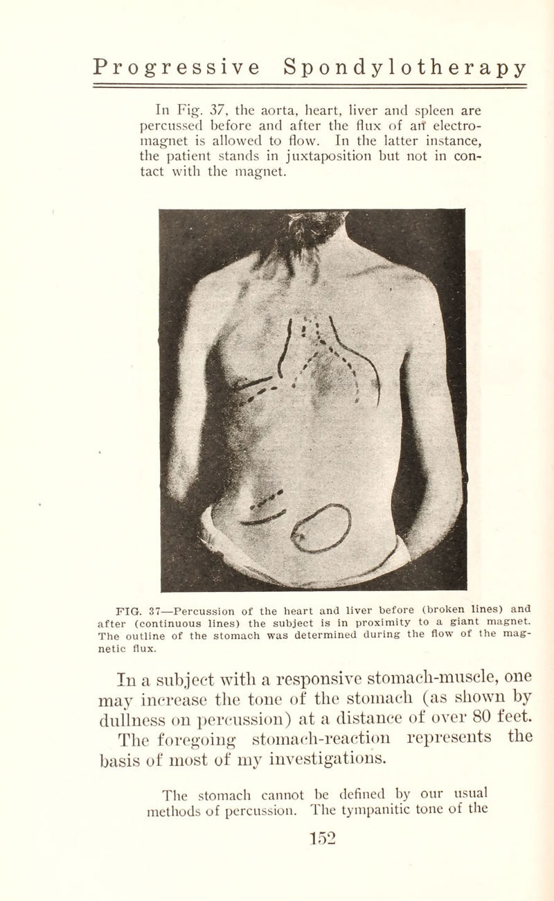 In Fig’. 37, the aorta, heart, liver and spleen are percussed before and after the flux of art electro¬ magnet is allowed to flow. In the latter instance, the patient stands in juxtaposition but not in con¬ tact with the magnet. FIG. 37—Percussion of the heart and liver before (broken lines) and after (continuous lines) the subject is in proximity to a giant magnet. The outline of the stomach was determined during the flow of the mag¬ netic flux. In a subject with a responsive stomach-muscle, one may increase the tone of the stomach (as shown by dullness on percussion) at a distance of over 80 feet. The foregoing stomach-reaction represents the basis of most of my investigations. The stomach cannot he defined by our usual methods of percussion. The tympanitic tone of the