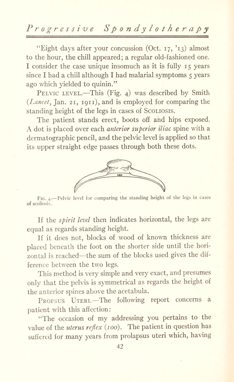 “Eight days after your concussion (Oct. 17, ’13) almost to the hour, the chill appeared; a regular old-fashioned one. I consider the case unique insomuch as it is fully 15 years since I had a chill although I had malarial symptoms 5 years ago which yielded to quinin.” Pelvic level.—This (Fig. 4) was described by Smith (Lancet, Jan. 21, 1911), and is employed for comparing the standing height of the legs in cases of Scoliosis. The patient stands erect, boots off and hips exposed. A dot is placed over each anterior superior iliac spine with a dermatographic pencil, and the pelvic level is applied so that its upper straight edge passes through both these dots. Fig. 4.—Pelvic level for comparing the standing height of the legs in cases of scoliosis. If the spirit level then indicates horizontal, the legs are equal as regards standing height. If it does not, blocks of wood of known thickness are placed beneath the foot on the shorter side until the hori¬ zontal is reached—the sum of the blocks used gives the dif¬ ference between the two legs. This method is very simple and very exact, and presumes only that the pelvis is symmetrical as regards the height of the anterior spines above the acetabula. Propsus Uteri.—The following report concerns a patient with this affection: “The occasion of my addressing you pertains to the value of the uterus reflex (100). The patient in question has suffered for many years from prolapsus uteri which, having