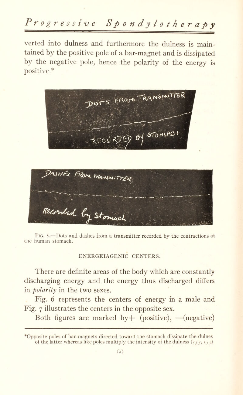 verted into dulness and furthermore the dulness is main¬ tained by the positive pole of a bar-magnet and is dissipated by the negative pole, hence the polarity of the energy is positive.* Fig. 5.—Dots and dashes from a transmitter recorded by the contractions ot the human stomach. ENERGEIAGENIC CENTERS. There are definite areas of the body which are constantly discharging energy and the energy thus discharged differs in polarity in the two sexes. Fig. 6 represents the centers of energy in a male and Fig. 7 illustrates the centers in the opposite sex. Both figures are marked by+ (positive), —(negative) ^Opposite poles of bar-magnets directed toward l.ie stomach dissipate the dulnos of the latter whereas like poles multiply the intensity of the dulness {ijj, ij-,) Ca)