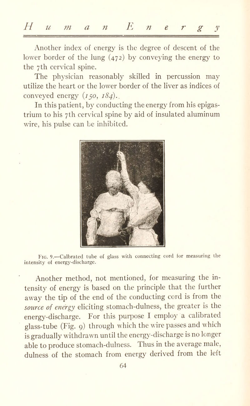 H u ?n a K n e r g y ?i Another index of energy is the degree of descent of the lower border of the lung (472) by conveying the energy to the 7th cervical spine. The physician reasonably skilled in percussion may utilize the heart or the lower border of the liver as indices of conveyed energy (750, 184).. In this patient, by conducting the energy from his epigas¬ trium to his 7th cervical spine by aid of insulated aluminum wire, his pulse can be inhibited. Fig. 9.—Calbrated tube of glass with connecting cord for measuring the intensity of energy-discharge. Another method, not mentioned, for measuring the in¬ tensity of energy is based on the principle that the further away the tip of the end of the conducting cord is from the source of energy eliciting stomach-dulness, the greater is the energy-discharge. For this purpose I employ a calibrated glass-tube (Fig. 9) through which the wire passes and which is gradually withdrawn until the energy-discharge is no longer able to produce stomach-dulness. Thus in the average male, dulness of the stomach from energy derived from the left