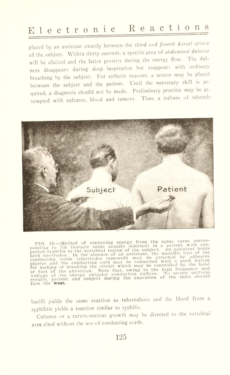 placed by an assistant exactly between the third and fourth dorsal spines of the subject. Within thirty seconds, a specific area of abdominal dulness will be elicited and the latter persists during the energy flow. Hie dul¬ ness disappears during deep inspiration but reappears with ordinary breathing by the subject. For esthetic reasons, a screen may be placed between the subject and the patient. Until the necessary skill is ac¬ quired, a diagnosis should not he made. Preliminary practice may be at¬ tempted with cultures, blood and tumors. Thus, a culture of tubercle PIG 16.—Method of conveying energy from the spine (area ci3 • ponding to 7th thoracic spine usually selected) in a Patient wit - pected syphilis to the vertebral region of the subject. An assistant the W ^■>,»»>- be connected with a push button be controlled by the hand the high frequency and suffices. To secure uniform results, patient and-subject during face the west. holds of the UC Ul tin aooioium, '•••' ---- , ‘ conducting cords (electrodes plaster and the conducting cord may for making or breaking the circuit which may or foot of the physician. Note that, owing to voltage of the energy unipolar jonduchon^^. of* the' tests should bacilli yields the same reaction as tuberculosis and the blood front a syphilitic yields a reaction similar to syphilis. Cultures or a carcinomatous growth may be directed to the vertebral area cited without the use of conducting cords.