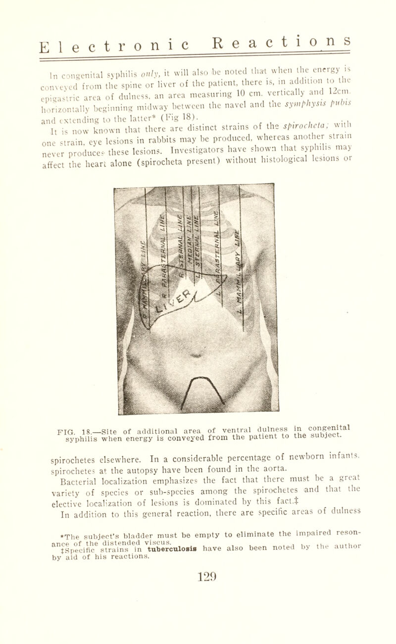 In congenital syphilis only, it will also be noted that when the energy i* conveyed from the spine or liver of the patient there is, m addition to I k epigastric area of dulness. an area measuring 10 cm. vertically and 12cm. horizontally beginning midway between the navel and the symphysis pubis and extending to the latter* (Fig 18). . , It is now known that there are distinct strains of the spirocheta, with one strain, eye lesions in rabbits may be produced, whereas another strain never produces' these lesions. Investigators have shown that syphilis may affect the heart alone (spirocheta present) without histological lesions ot FIG. 18.—Site of additional area syphilis when energy is conveyed of ventral dulness in congenital from the patient to the subject. spirochetes elsewhere. In a considerable percentage of newborn infants, spirochetes at the autopsy have been found in the aorta. Bacterial localization emphasizes the fact that there must be a 8mat variety of species or sub-species among the spirochetes and that the elective localization of lesions is dominated by this fact.$ In addition to this general reaction, there are specific areas of dulness *The subject’s bladder must be empty to eliminate the impaired reson- alltSpecific6 strains^ ^n tuberculosis have also been noted by the author by aid of his reactions. 120