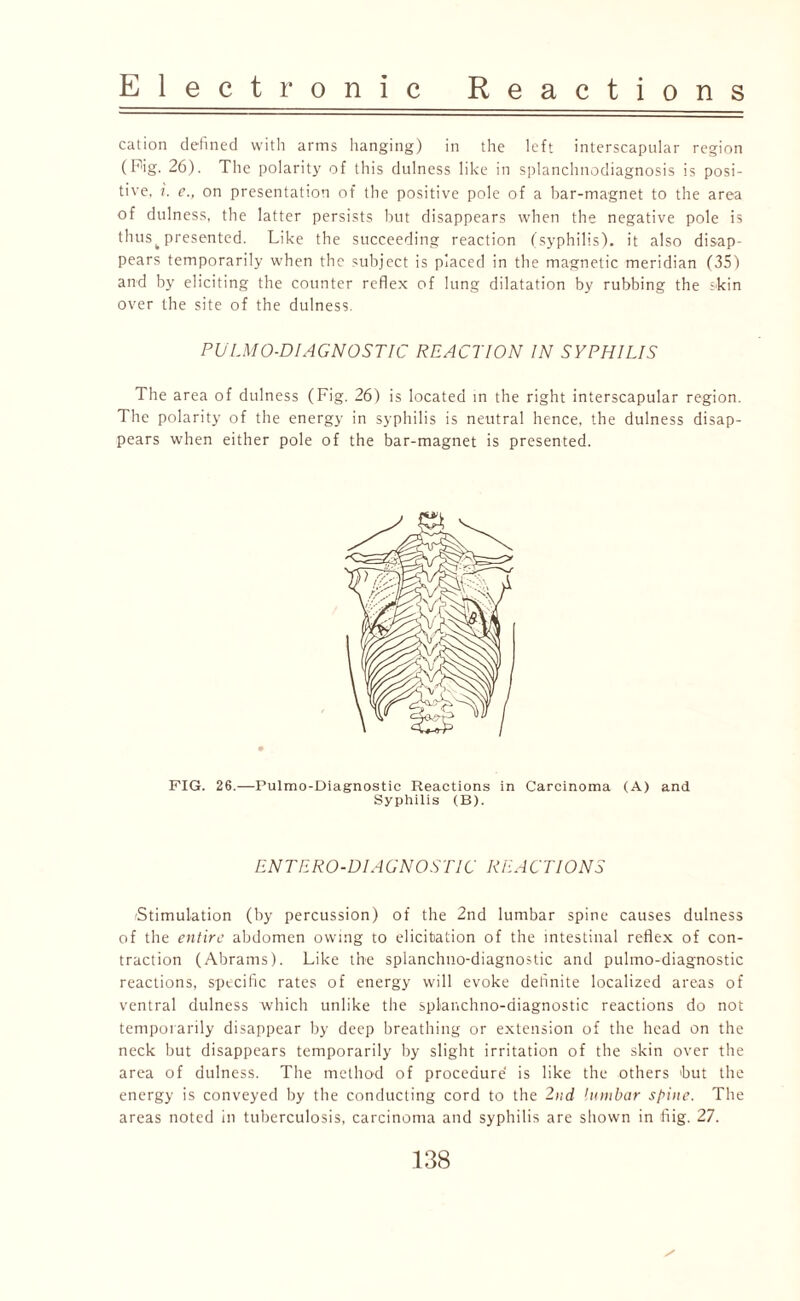 cation defined with arms hanging) in the left interscapular region (Pig. 26). The polarity of this dulness like in splanchnodiagnosis is posi¬ tive, i. e., on presentation of the positive pole of a bar-magnet to the area of dulness, the latter persists but disappears when the negative pole is thusk presented. Like the succeeding reaction (syphilis), it also disap¬ pears temporarily when the subject is placed in the magnetic meridian (35) and by eliciting the counter reflex of lung dilatation by rubbing the skin over the site of the dulness. PULMO-DIAGNOSTIC REACTION IN SYPHILIS The area of dulness (Fig. 26) is located in the right interscapular region. The polarity of the energy in syphilis is neutral hence, the dulness disap¬ pears when either pole of the bar-magnet is presented. FIG. 26.—Pulmo-Diagnostic Reactions in Carcinoma (A) and Syphilis (B). ENTERO-DlAGNOSTIC REACTIONS /Stimulation (by percussion) of the 2nd lumbar spine causes dulness of the entire abdomen owing to elicitation of the intestinal reflex of con¬ traction (Abrams). Like the splanchno-diagnostic and pulmo-diagnostic reactions, specific rates of energy will evoke definite localized areas of ventral dulness which unlike the splanchno-diagnostic reactions do not temporarily disappear by deep breathing or extension of the head on the neck but disappears temporarily by slight irritation of the skin over the area of dulness. The method of procedure' is like the others but the energy is conveyed by the conducting cord to the 2nd lumbar spine. The areas noted in tuberculosis, carcinoma and syphilis are shown in fug. 27.