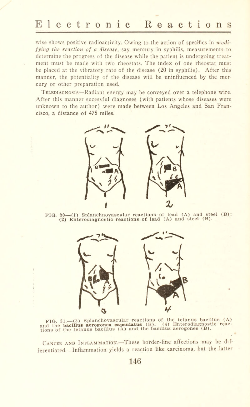 wise shows positive radioactivity. Owing to the action of specifics in modi¬ fying the reaction of a disease, say mercury in syphilis, measurements to determine the progress of the disease while the patient is undergoing treat¬ ment must be made with two rheostats. The index of one rheostat must be placed at the vibratory rate of the disease (20 in syphilis). After this manner, the potentiality of the disease will be uninfluenced by the mer¬ cury or other preparation used. Telediagnosis—Radiant energy may be conveyed over a telephone wire. After this manner sucessful diagnoses (with patients whose diseases were unknown to the author) were made between Los Angeles and San Fran¬ cisco, a distance of 475 miles. FIG. 30—(1) Splanchnovascular reactions of lead (A) and steel (B): (2) Enterodiagnostic reactions of lead (A) and steel (B). 31_(3) Splanchovascular reactions of the tetanus bacillus (A) and the bacillus aerogones capsulatus (B). (4) Enterodiagnostic reac¬ tions of the tetanus bacillus (A) and the bacillus aerogones (B). Cancer and Inflammation.—These border-line affections may be dif¬ ferentiated. Inflammation yields a reaction like carcinoma, but the latter