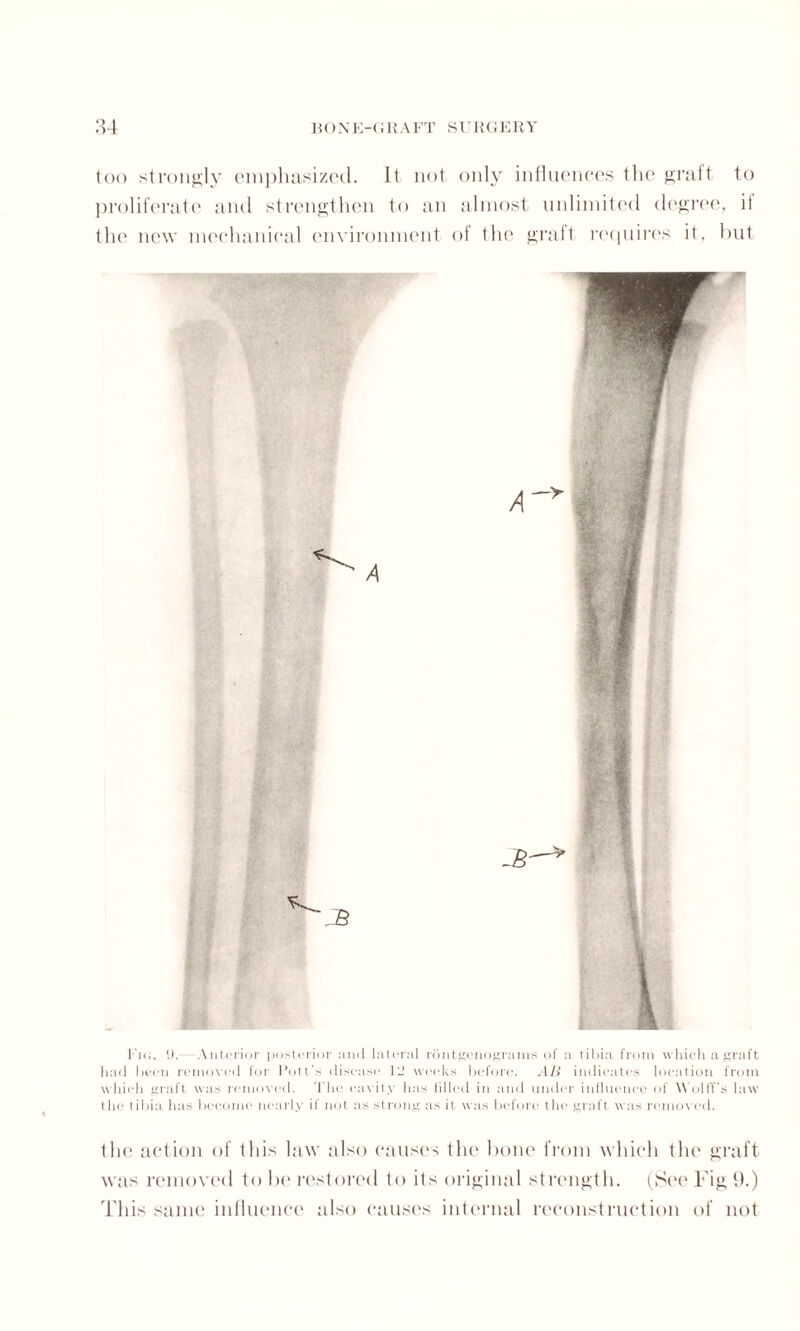 too strongly emphasized. It not only influences the graft to proliferate and strengthen to an almost unlimited degree, it the new mechanical environment of the graft requires it, but Etc. 9. Anterior posterior and lateral rontgenograms of a tibia from which a graft had been removed for Pott's disease 12 weeks before. AB indicates location from which graft was removed. The cavity has tilled in and under influence of Wolff’s law I he l ibia has become nearly if not as strong as it was before the graft was removed. the action of this law also causes the bone from which the graft was removed to be restored to its original strength. (See Fig 9.) This same influence also causes internal reconstruction of not