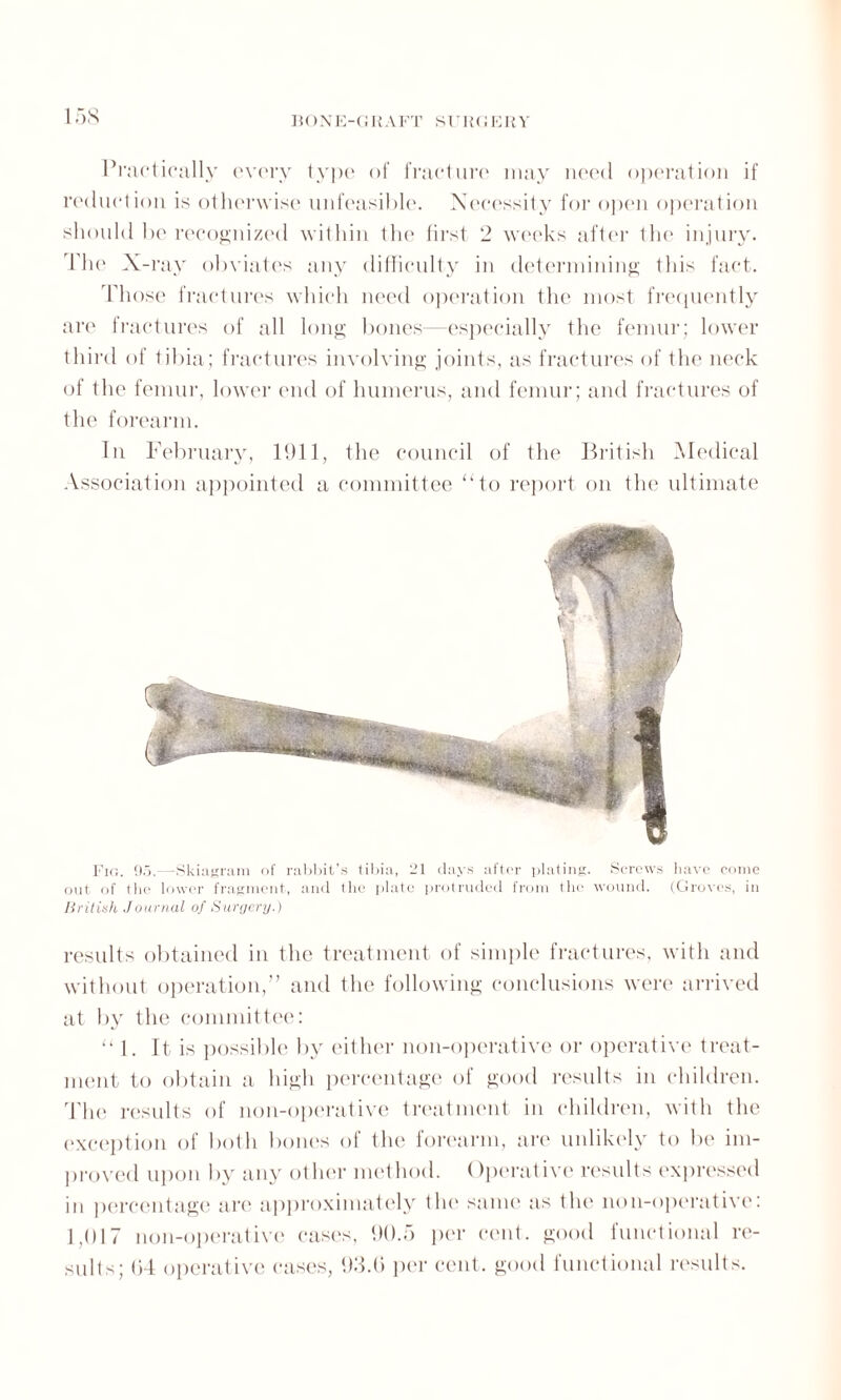 1 58 Practically every type of fracture may need operation if reduction is otherwise unfeasible. Necessity for open operation should be recognized within the first 2 weeks after the injury. The X- ray obviates any difficulty in determining this fact. Those fractures which need operation the most frequently are fractures of all long bones-—especially the femur; lower third of tibia; fractures involving joints, as fractures of the neck of the femur, lower end of humerus, and femur; and fractures of the forearm. In February, 1911, the council of the British Medical Association appointed a committee “to report on the ultimate Fig. 95.—Skiagram of rabbit’s tibia, 21 days after plating. Screws have come out of the lower fragment, and the plate protruded from the wound. (Groves, in British Journal of Surgery.) results obtained in the treatment of simple fractures, with and without operation,” and the following conclusions were arrived at by the committee: “ 1. It is possible by either non-operative or operative treat¬ ment to obtain a high percentage of good results in children. The results of non-operative treatment in children, with the exception of both bones of the forearm, are unlikely to be im¬ proved upon by any other method. Operative results expressed in percentage arc approximately the same as the 11011-operative: 1,017 11011-operative cases, 90.5 per cent, good functional re¬