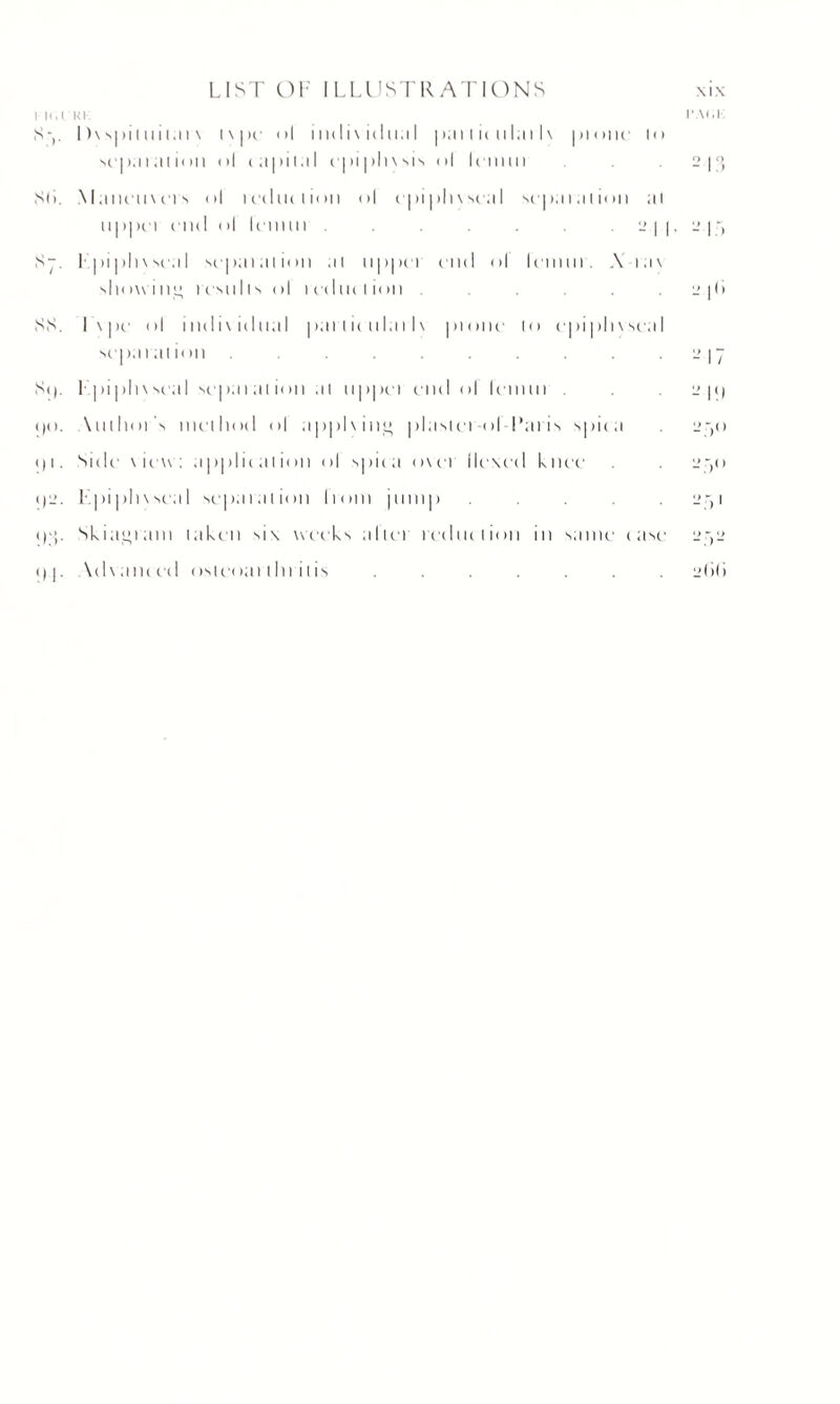 i'll,IKK i’a<;k SI )\s|)iliiii.ii \ tvpe i>l iiidix itlu.il part ic nlari v pione to sepal at ion ul capital cpi | )l i \ sis ol Icimii . . 2.13 Sli. Maneuvers ol reduction ol epiphvscal sepaialion al 111 >| H I (.‘11(1 ol IcilHI I . . 2 | |, 2.| 5 Sj. 1 | > 1 pli\seal sepal al ion al 11 p pci end ol lemiii. A ia\ showing results ol reduction . . 2 pi SS. L\pe ol individual paiiicnlarlv prone to epiplivseal separation .......... 2)7 Si), l.pi|)li\seal separation al nppei end ol leiinn . 2 p) ()o. Author s method ol applying plaster-ol I'aris spica 250 <) 1. Side view: application ol spua over hexed knee . 250 <)2. Lpiphvseal separation Irom jiinip ..... 251 i)‘P Skiagram taken six weeks altci rednclion in same case 252 () P Adv anced osteoai tin itis ....... 2<>(>
