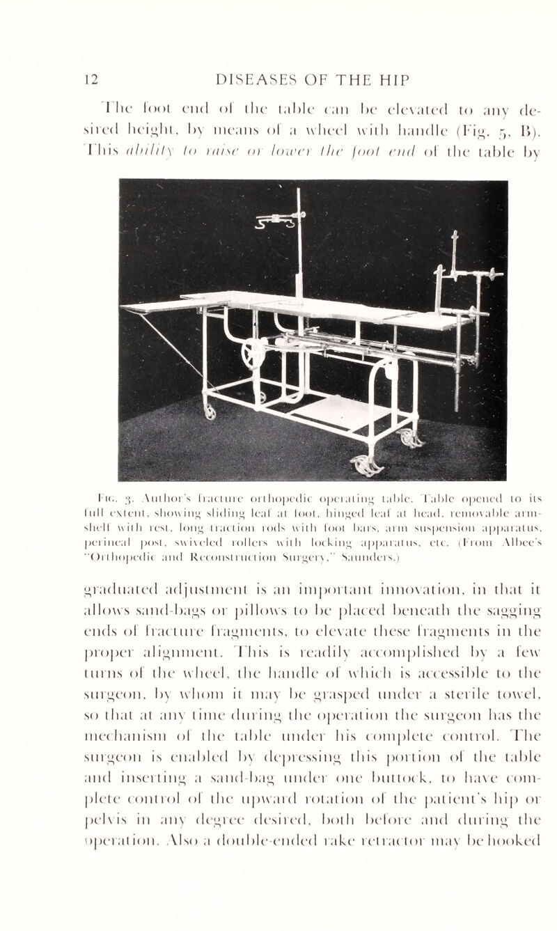 1 lie loot end ol the table can he elevated to any de¬ sired height, by means of a wheel with handle (Fig. r)t I>). I his abihlx to raise 01 lozen llic fool end ol the table by lii.. 3. Author's fracture orthopedic operating table. table opened to its lull extent, showing sliding leaf at loot, hinged leaf at head, removable arm- shell with rest, long traction rods with fool bars, arm suspension apparatus, perineal posl, swiveled rollers with locking apparatus, etc. (From AI bee’s “Orthopedic and Reconstruction Surgcrv, Saunders.) graduated adjustment is an important innovation, in that it allows sand-bags or pillows to be placed beneath the sagging ends ol tract tire fragments, to elevate these I ragmen ts in the proper alignment. This is readily accomplished by a few turns ol the wheel, the handle ol which is accessible to the surgeon, by whom it may be grasped under a sterile towel, so that at any time dining the operation the surgeon has the mechanism ol the table under his complete control. The surgeon is enabled bv depressing this portion ol the table and inserting a sand-bag under one Imttock, to have com¬ plete control ol the1 upward rotation of the patient's hip or pelvis in am degree desired, both before and during the operation. Also a double-ended rake retractor mav be hooked