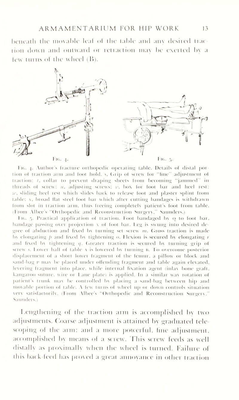 beneath the movable leal ol the table and am desired tia< lion down and outward or retraction may be exerted by a U'w t m ns ol the wheel ( P>). I n.. |. \uthors I r;ictlire orthopedic opcr;il ing t.ible. Details ol distal poi lion ol traction arm and loot hold. y. (.rip ol screw lot “line adjnsinient ol traction: /. collai to preveni draping sheets l’rom becoming “jammed in threads ol screw: //. adjusting screws: v, bos lor tool bat and bed rest; ;e. sliding heel rest which slides back to release loot and plastei splint from table: \, broad Hal steel loot bat which after cutting bandages is withdrawn from slot in traction arm. thus freeing completely patient s foot from table. From Albee's “Orthopedic and Reconstruction Surgery. Saunders.) I k., j. [’radical application of traction. Foot bandaged 1>\ p to foot bar. bandage passing o\et projection \ ol loot bar. leg is swung into desired de¬ gree of abduction and fixed by turning set screw in. (.toss traction is made l>\ elongating ji and fixed by tightening <>. flexion is scented In elongating r and fixed by tightening i/. (heater traction is seemed by turning grip ol screw '. I owet hall ol table y is lowered by turning tc. lo mercoinc posterioi displacement ol a short lowci fragment ol the femur, a pillow or block and sand bag t’ ma\ be placed nuclei offending fragment and table again elevated, levering Iragment into place, while internal fixation agent (inlay bone graft, kangaroo suture, ccite or I ane plate) is applied. In a similar y\ay rotation of patient's 11 link may be controlled by placing a sand bag between hip and moyable portion ol table. \ levy tin ns ol wheel up or down controls situation verv satisfactorily. (From Albee's “Orthopedic and Reconstruction Surgery. Saunders.) Lengthenin'; ol the traction arm is accomplished l>\ two adjustments. Coarse adjustment is attained by graduated tele scoping ol the arm: and a more powerful, line adjustment, accomplished l>\ means ol a st rew. This st rew feeds as well distallx as proximallv when the wheel is turned. Failure ol this hack Iced has proved a great annoyance in otliet traction