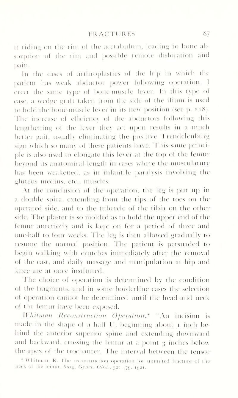 it tiding on the lim ol (lie ;n elalmlum. leading lo hone- ab soi pi ion ol dii' l im and possible remote dislocation and pain. In die i.isi's ol ai throplast irs ol dir hip in which die patient lias weak abdnctoi powei billowing opeiation, I erect the same t\pe ol bone muscle lexer. In this type1 ol ease, a wedge 141 all taken Iroin the' side ol the' ilium is used to hold the hone muse le level in its new posit ion tsee p. 2 1 <Sp I lie increase ol efliriencx ol the abductors billowing this lengthening ol the lexei lhe\ at t upon results in a much hettei n a i t. usuallx eliminating die posilixe I rendelenburg si<4n w idt h so mam ol these pat i enls ha\ e. I his same print i pie is also used to elongate this lexer at the top ol the lenitti hexontl its anatomical length in cases where the must ulatiuc has been weakened, as in inlantile paralxsis invoking the gluteus meditts. etc., must les. At the conclusion ol the operation, the lee, is put up in a double spica, extending Irom the tips ol the toes on the operated side, and to the tubercle ol the tibia on the other side. The plaster is so molded as to hold the upper end ol the lemur anteriorly and is kept on loi a period ol three and one-hall to lout weeks. The lee, is then allowed gradually to lesnme the normal position. I he patient is persuaded to begin walking with crutches immediately alien the remoxal ol the fast, and dailx massage and manipulation at hip and knee are at once inst it tiled. I he choice ol operation is determined hx the condition ol the fragments, and in some borderline cases the selection ol operation cannot he determined until the head and neck o! the let mu hare been exposed. II hilnimi Recous!nt< lion ()jiemlion.* “An incision is made in the shape ol a hall l . beginning about 1 inch be hind the anterior supei ior spine and extending downward and backward, crossing the lemur at a point g inches below the apex ol the I rot banter. I lie inlet \ al between the lensoi XX hii man. R the i ft (him i lit 1 ion o|)cialion for miiiiiilt'il fracture of the lift k ol ihe lemur. .S104. C.\mi. Olisl., 171). itjai.